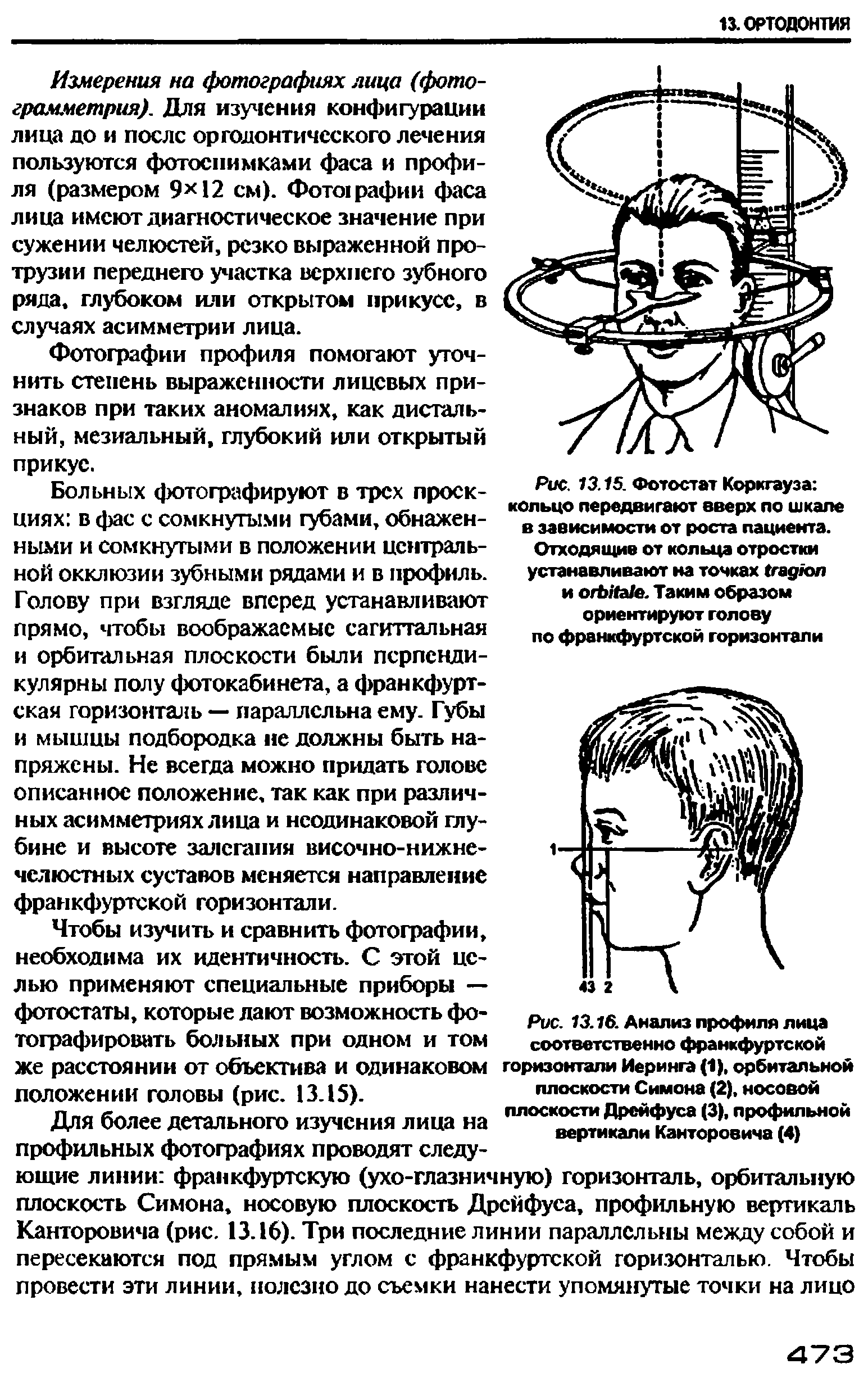 Рис. 13.16. Анализ профиля лица соответственно франкфуртской горизонтали Иеринга (1), орбитальной плоскости Симона (2), носовой плоскости Дрейфуса (3), профильной вертикали Канторовича (4)...