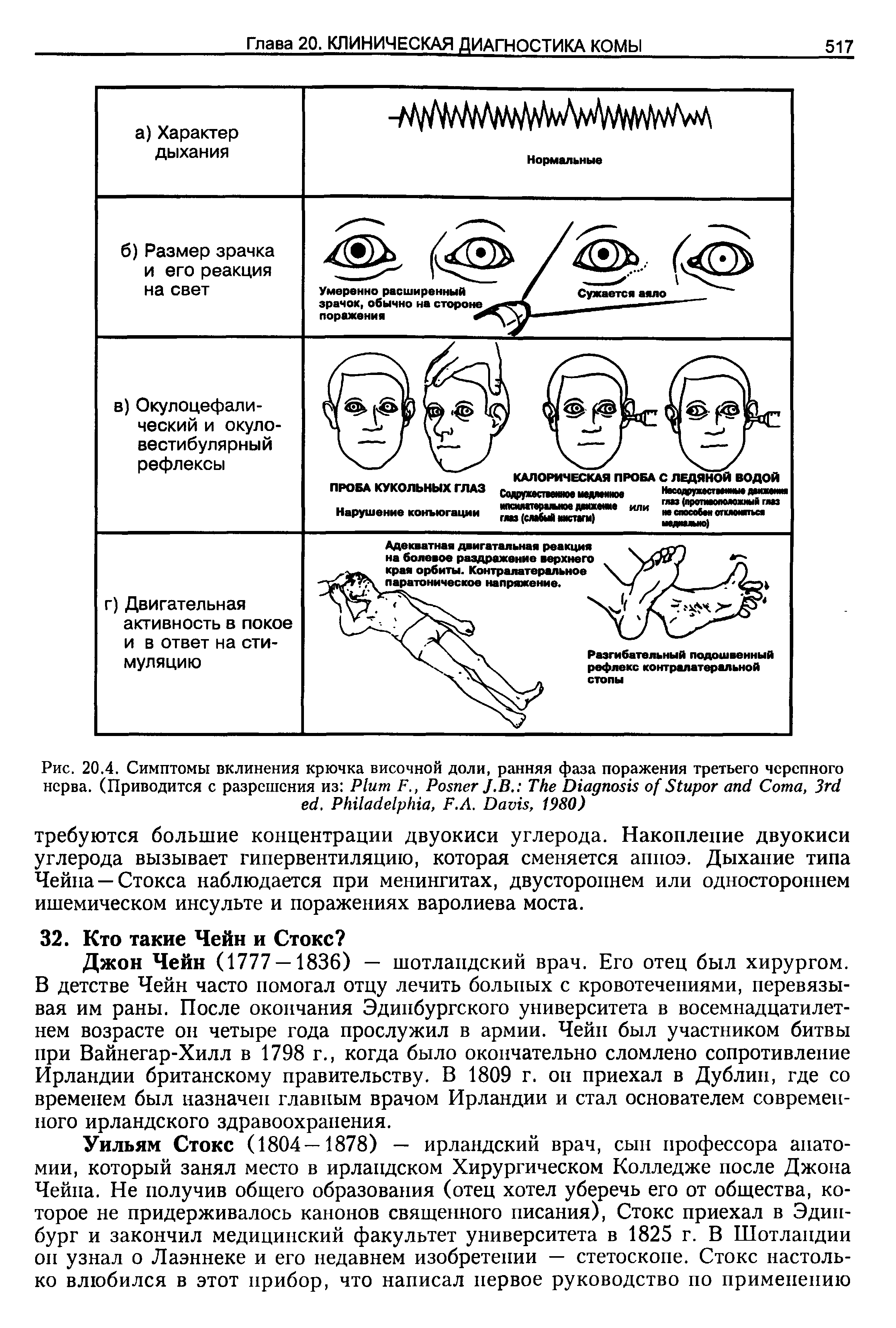 Рис. 20.4. Симптомы вклинения крючка височной доли, ранняя фаза поражения третьего черепного нерва. (Приводится с разрешения из P F., P J. В. T D S C , 3 . P , F.A. D , 1980)...