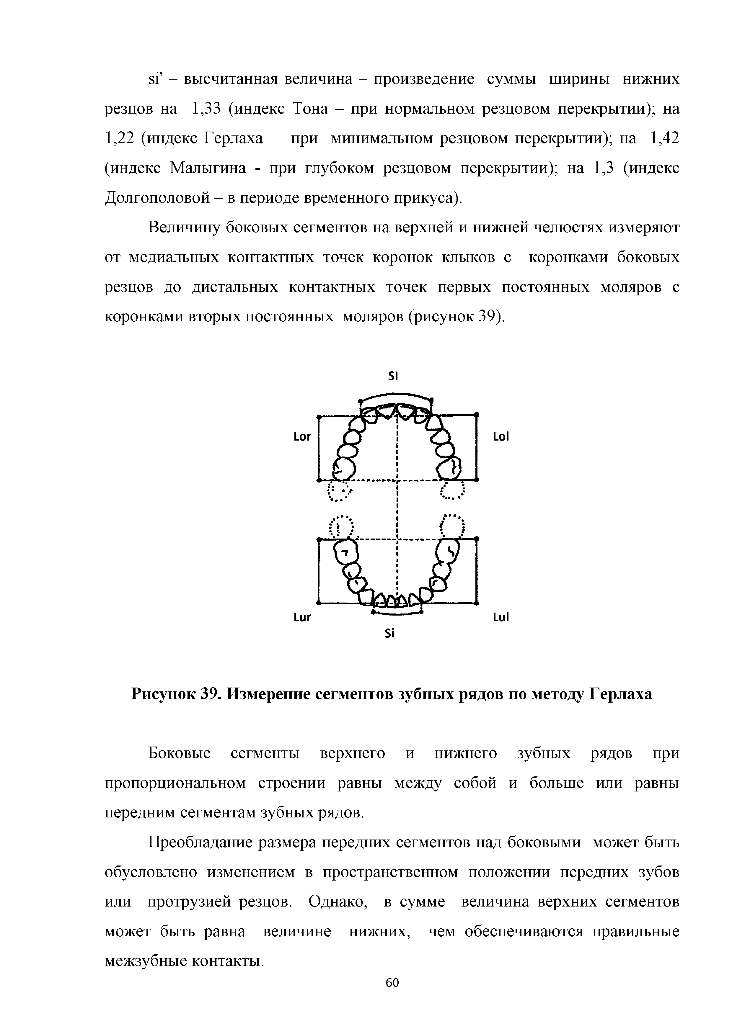 Рисунок 39. Измерение сегментов зубных рядов по методу Герлаха...