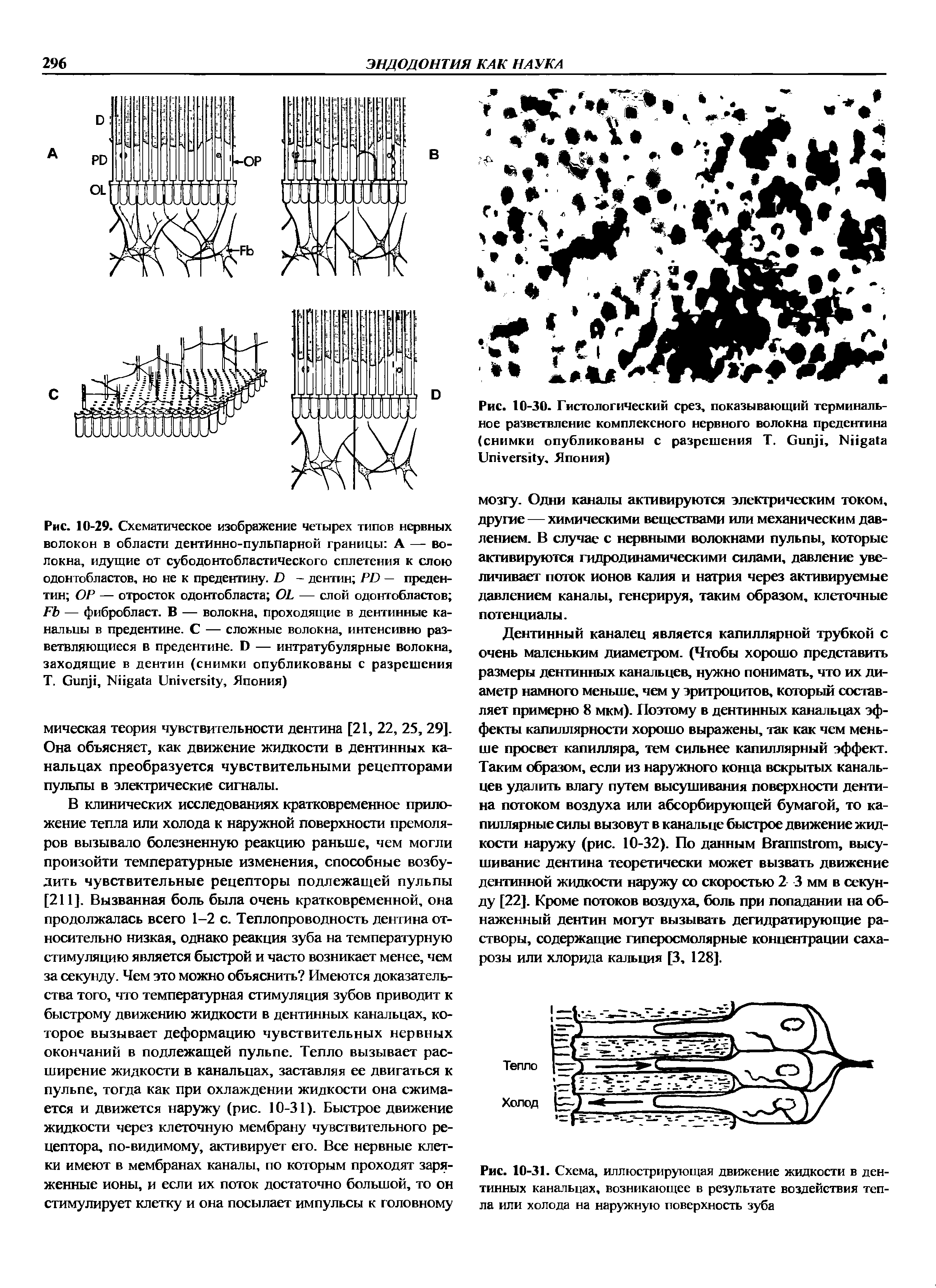 Рис. 10-31. Схема, иллюстрирующая движение жидкости в дентинных канальцах, возникающее в результате воздействия тепла или холода на наружную поверхность зуба...