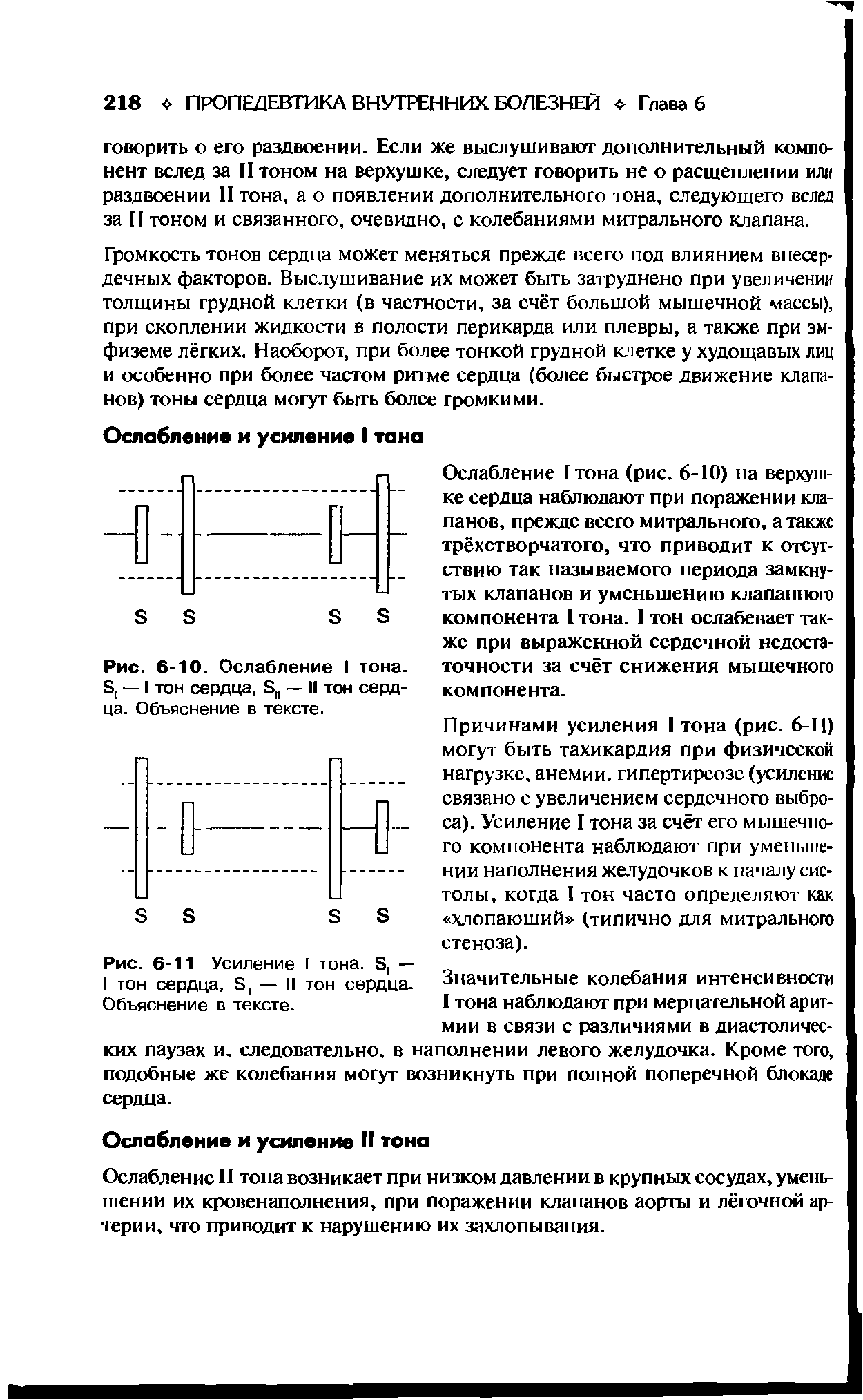 Рис. 6-11 Усиление I тона. Б, — I тон сердца, Б — II тон сердца. Объяснение в тексте.