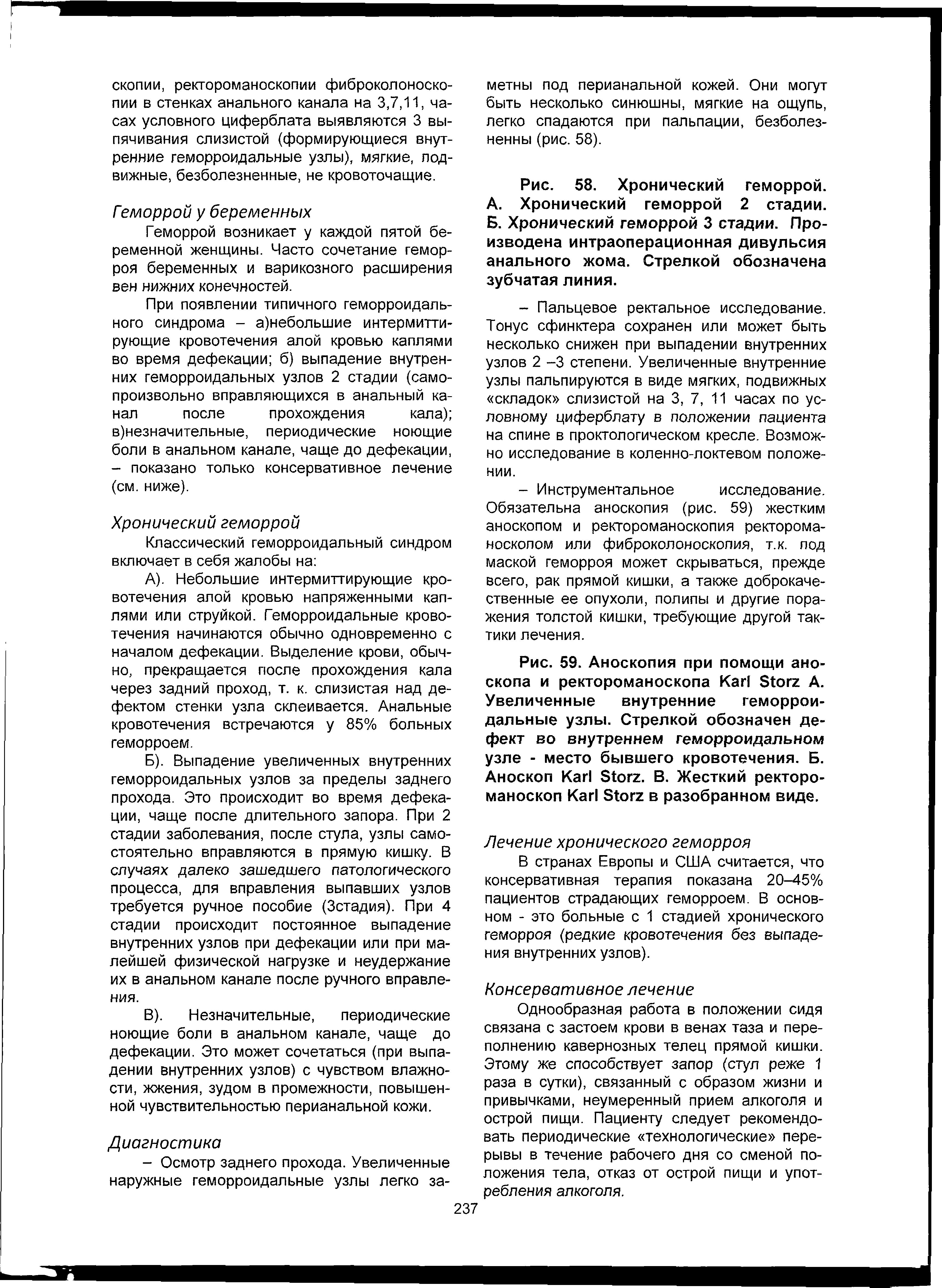 Рис. 58. Хронический геморрой. А. Хронический геморрой 2 стадии. Б. Хронический геморрой 3 стадии. Произведена интраоперационная дивульсия анального жома. Стрелкой обозначена зубчатая линия.