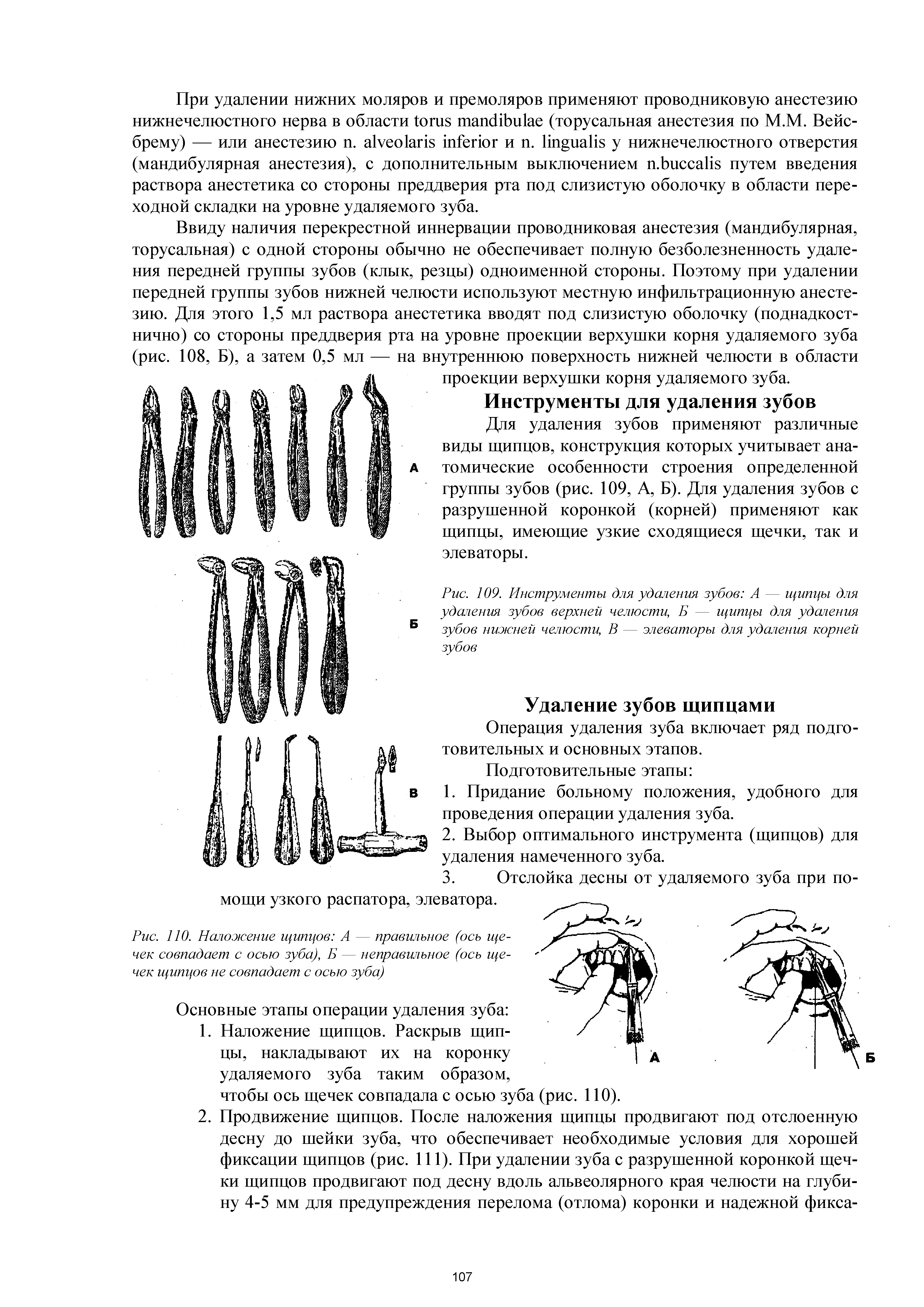 Рис. 109. Инструменты для удаления зубов А — щипцы для удаления зубов верхней челюсти, Б — щипцы для удаления зубов нижней челюсти, В — элеваторы для удаления корней зубов...