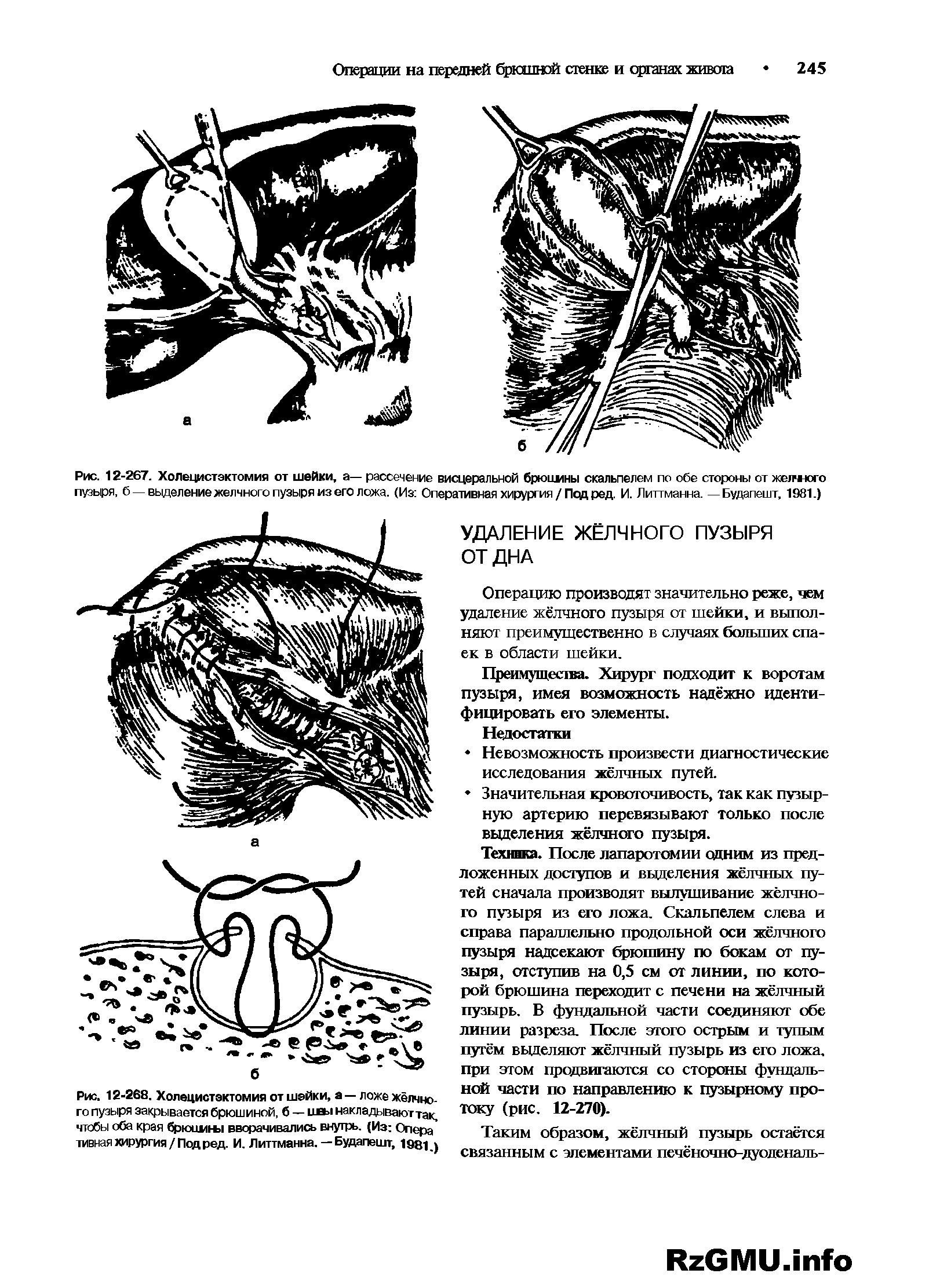 Рис. 12-267. Холецистэктомия от шейки, а— рассечение висцеральной брючины скальпелем по обе стороны от желчного пузыря, б — выделение желчного пузыря из его ложа. (Из Оперативная хирургия / Под ред. И. Литтманна. —Будапешт, 1981.)...