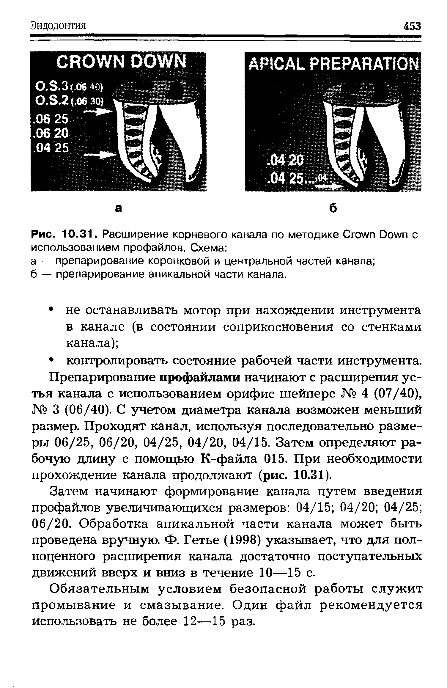 Рис. 10.31. Расширение корневого канала по методике C D с использованием профайлов. Схема ...