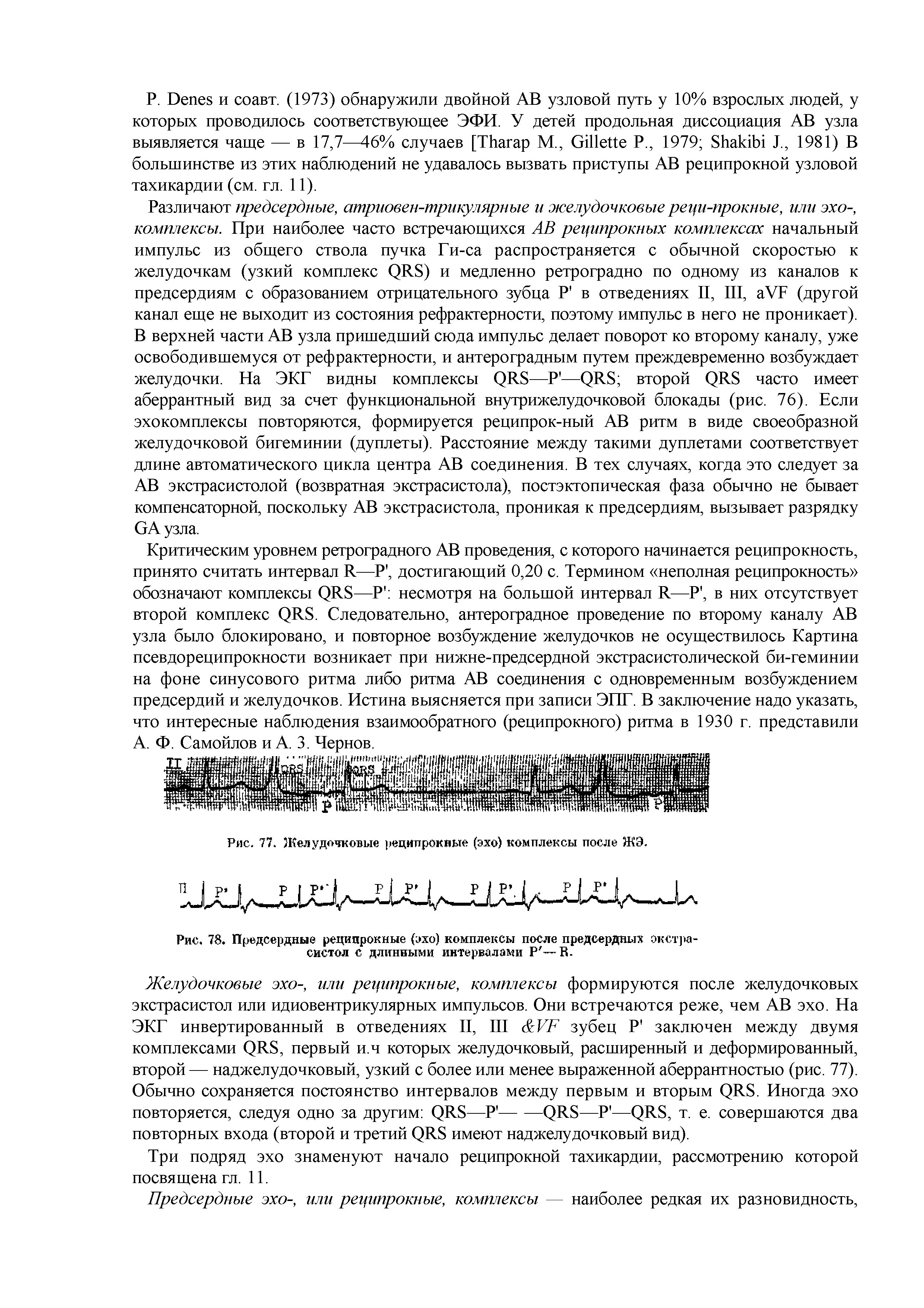 Рис. 78. Предсердные реципрокные (эхо) комплексы после предсердных экстрасистол с длинными интервалами Р —В.