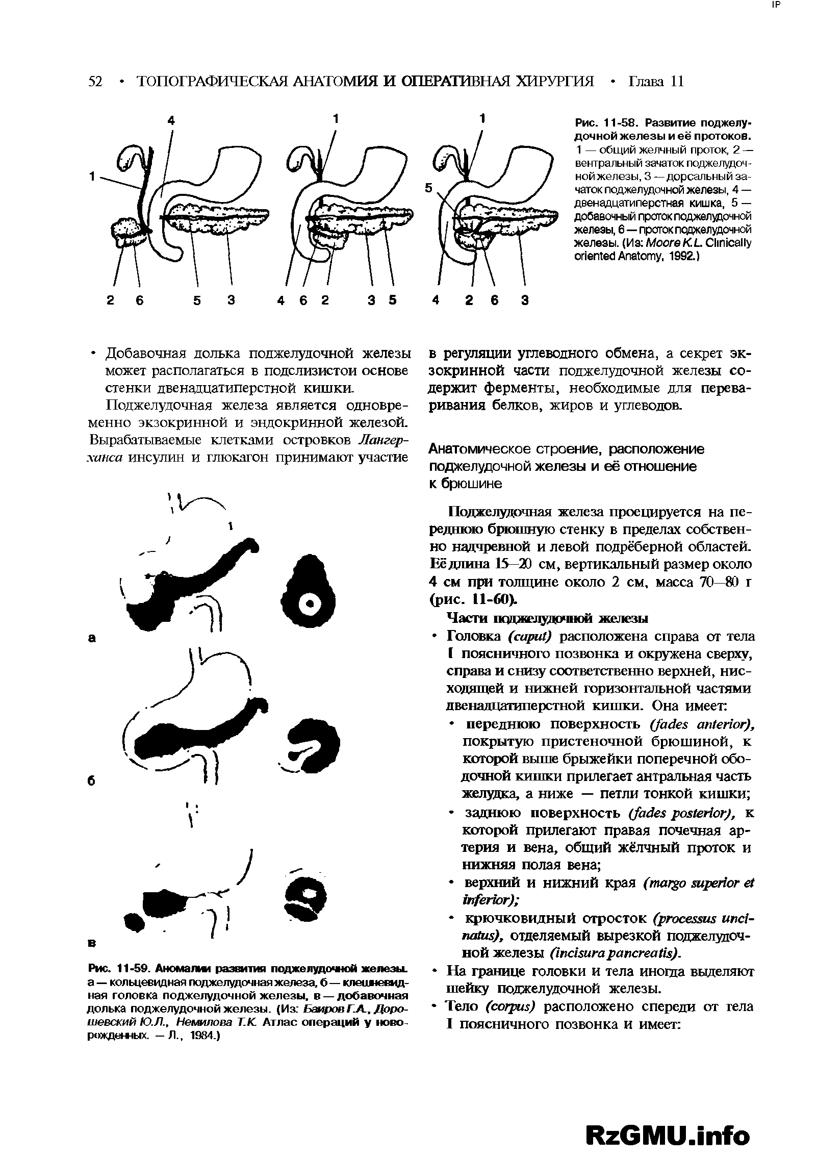 Рис. 11-59. Аномалш развития поджелудочной железы, а — кольцевидная поджелудочная железа, б — клешневидная головка поджелудочной железы, в — добавочная долька поджелудочной железы. (Из Баиров Г.А., Доро-шевский Ю.Л., Неьылова Т.К Атлас операций у новорожденных. — Л., 1984.)...