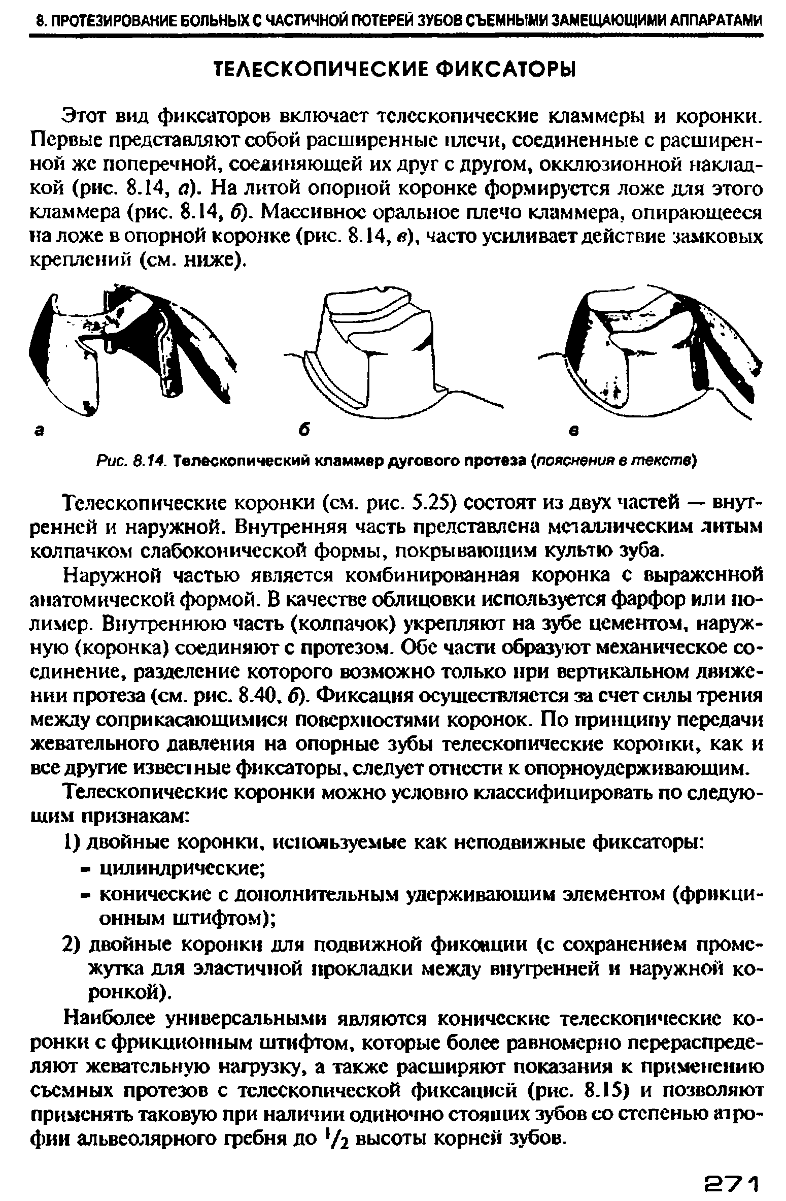 Рис. 8.14. Телескопический кламмер дугового протеза (пояснения в тексте)...