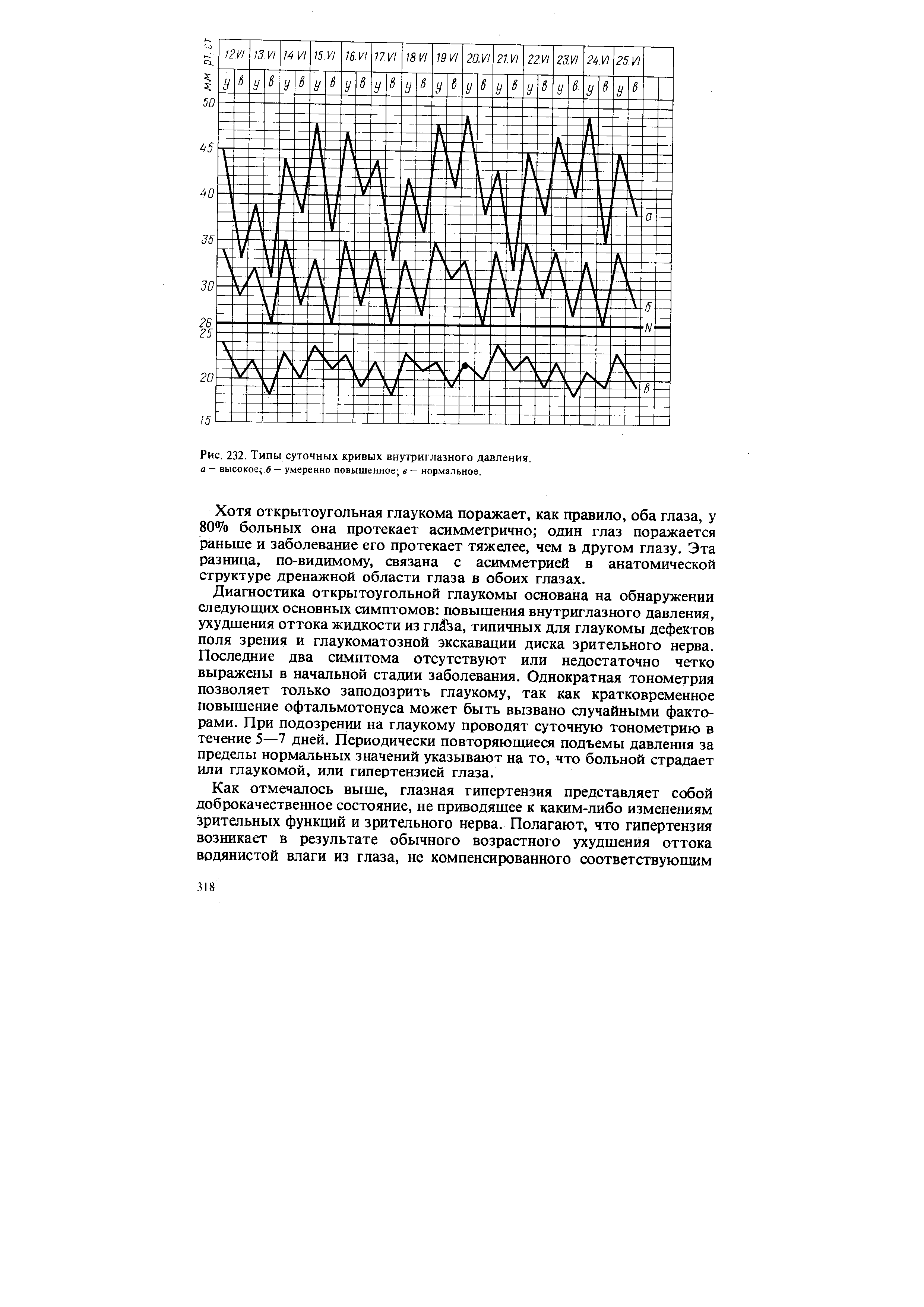 Рис. 232. Типы суточных кривых внутриглазного давления. а — высокое. , — умеренно повышенное в — нормальное.