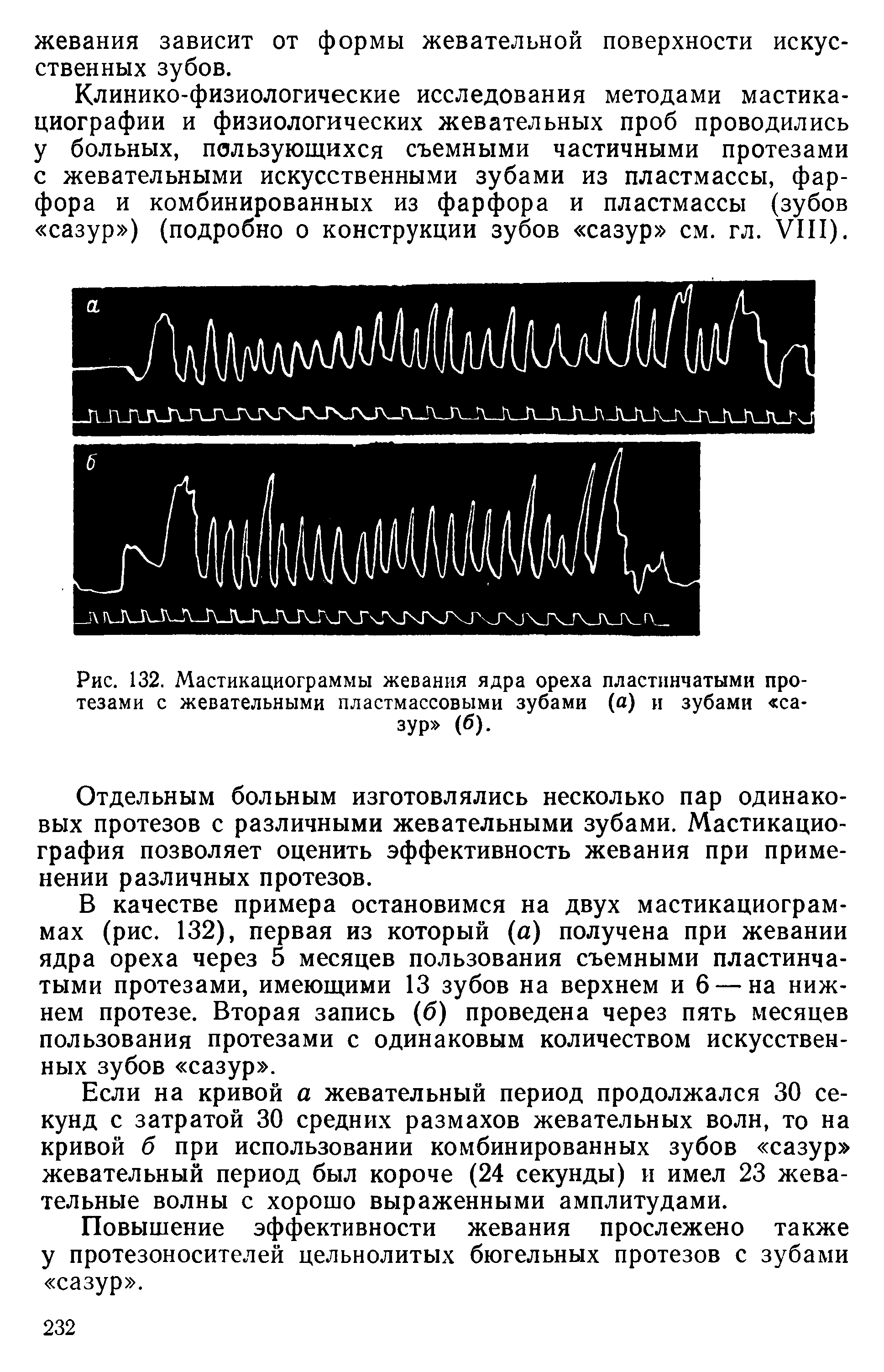 Рис. 132. Мастикациограммы жевания ядра ореха пластинчатыми протезами с жевательными пластмассовыми зубами (а) и зубами сазур (б).