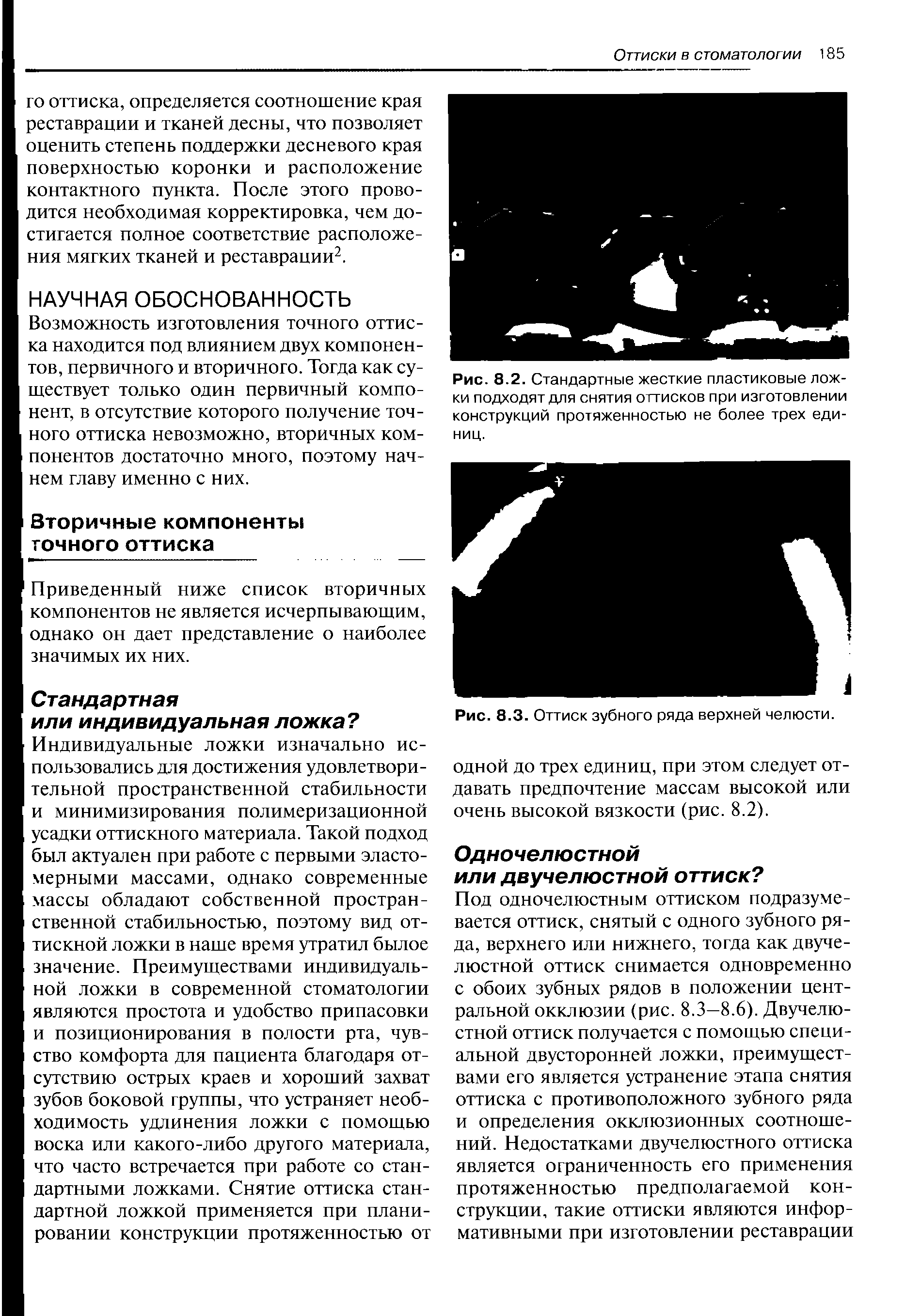 Рис. 8.2. Стандартные жесткие пластиковые ложки подходят для снятия оттисков при изготовлении конструкций протяженностью не более трех единиц.