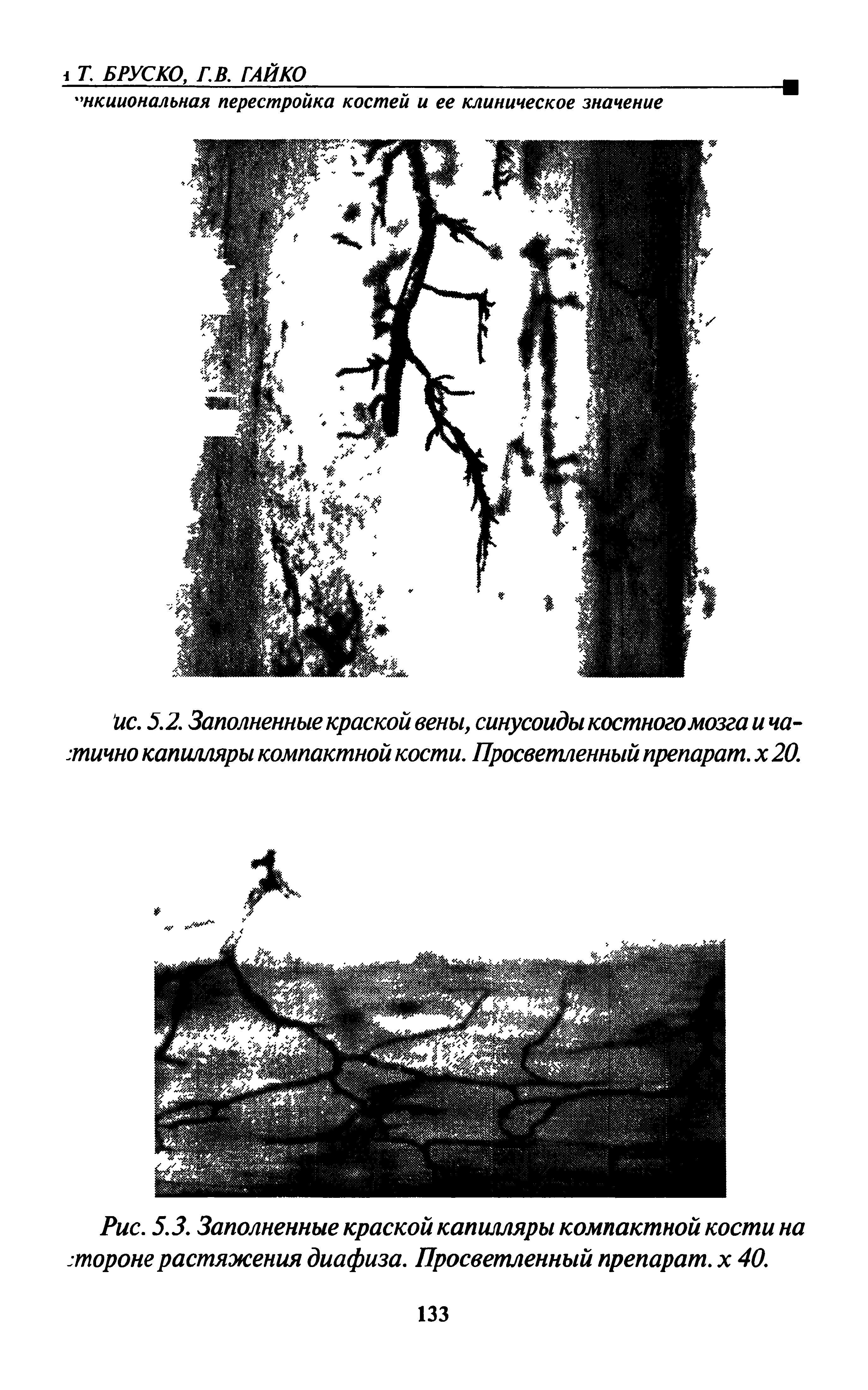 Рис. 5.3. Заполненные краской капилляры компактной кости на тороне растяжения диафиза. Просветленный препарат, х 40.