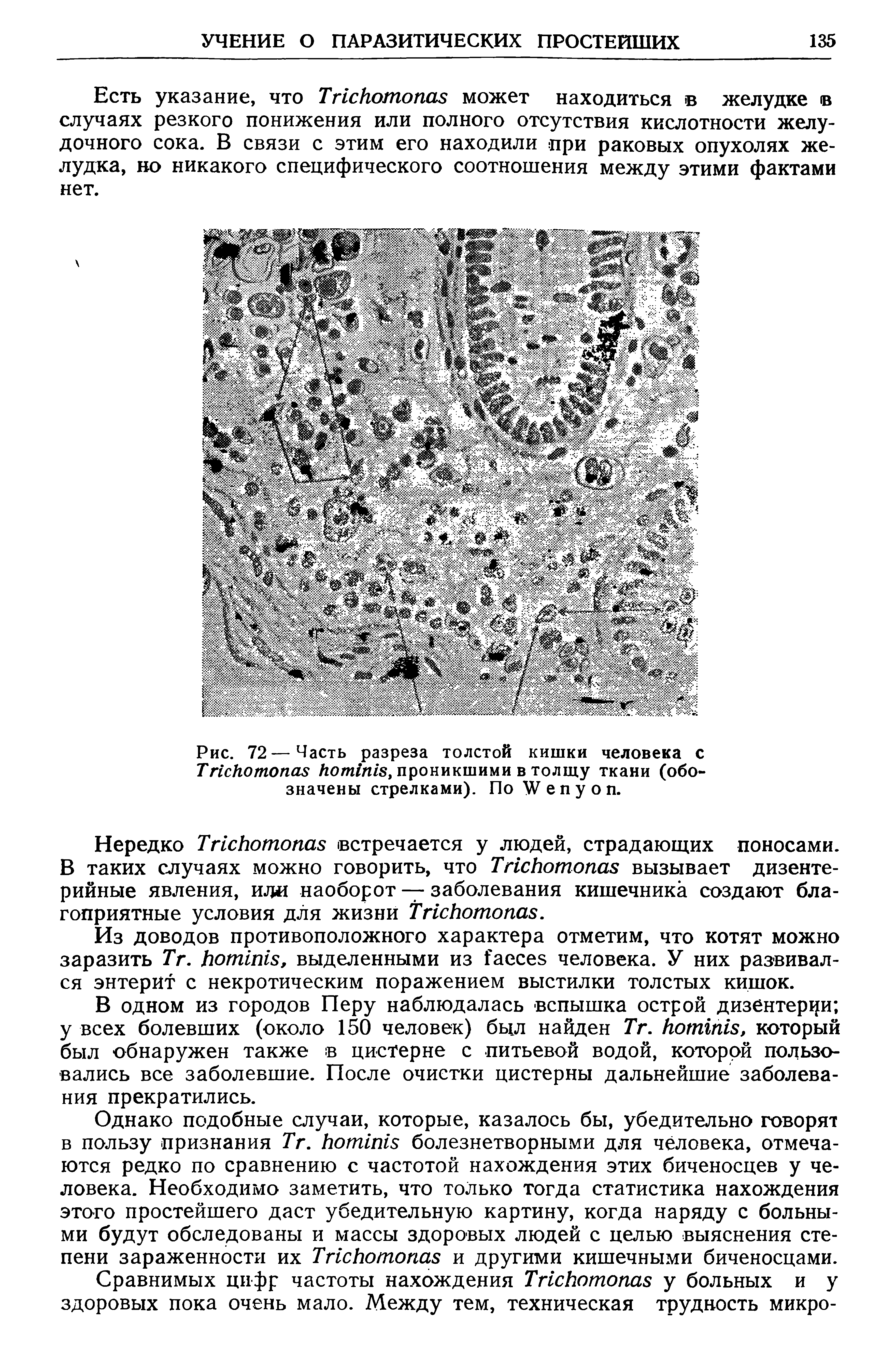 Рис. 72—Часть разреза толстой кишки человека с T K A A AB ткани (обозначены стрелками). По W .