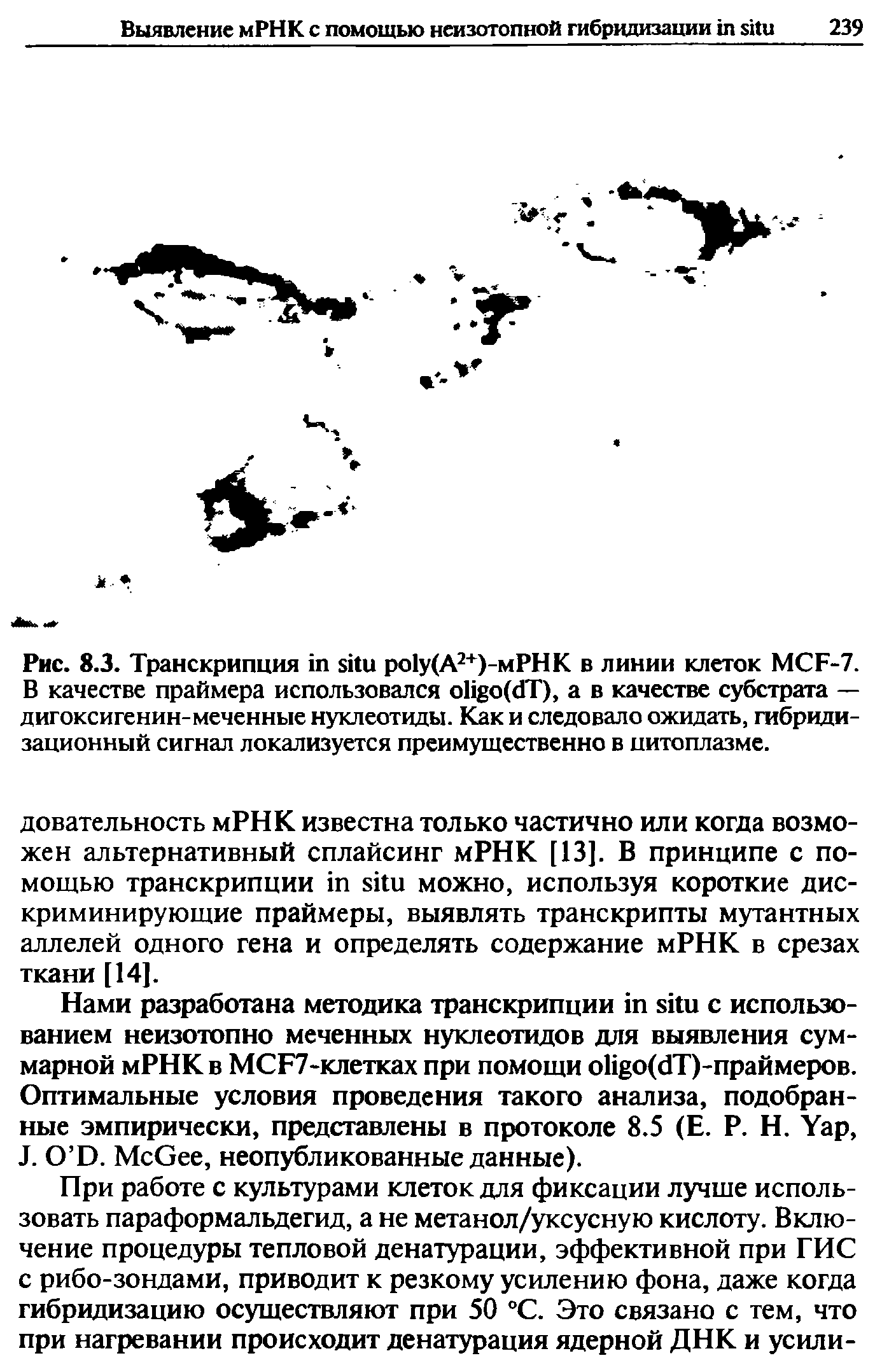 Рис. 8.3. Транскрипция ро1у(А2+)-мРНК в линии клеток MCF-7. В качестве праймера использовался ( T), а в качестве субстрата — дигоксигенин-меченные нуклеотиды. Как и следовало ожидать, гибридизационный сигнал локализуется преимущественно в цитоплазме.