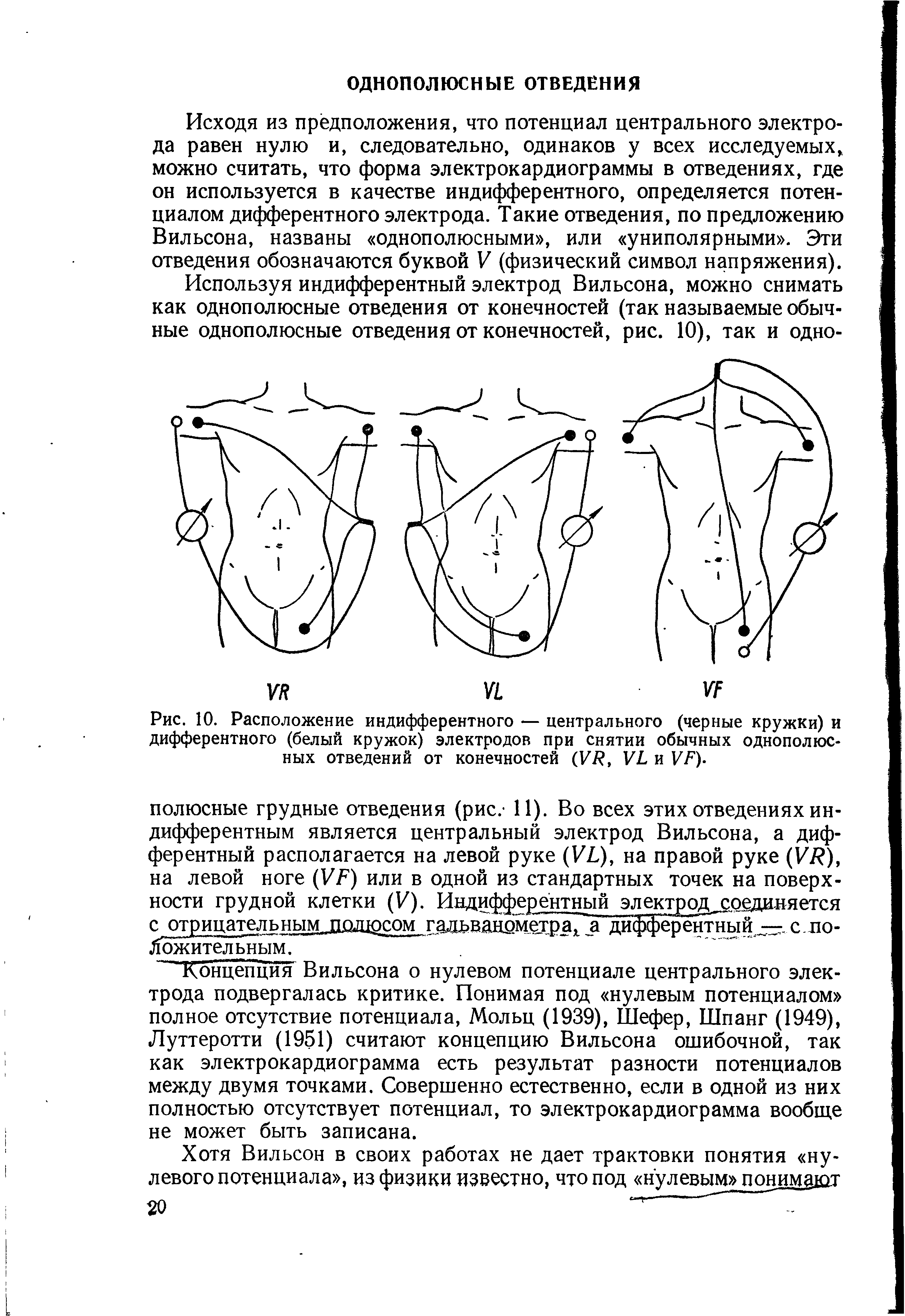 Рис. 10. Расположение индифферентного — центрального (черные кружки) и дифферентного (белый кружок) электродов при снятии обычных однополюсных отведений от конечностей (УТ , УЬ и V/7).