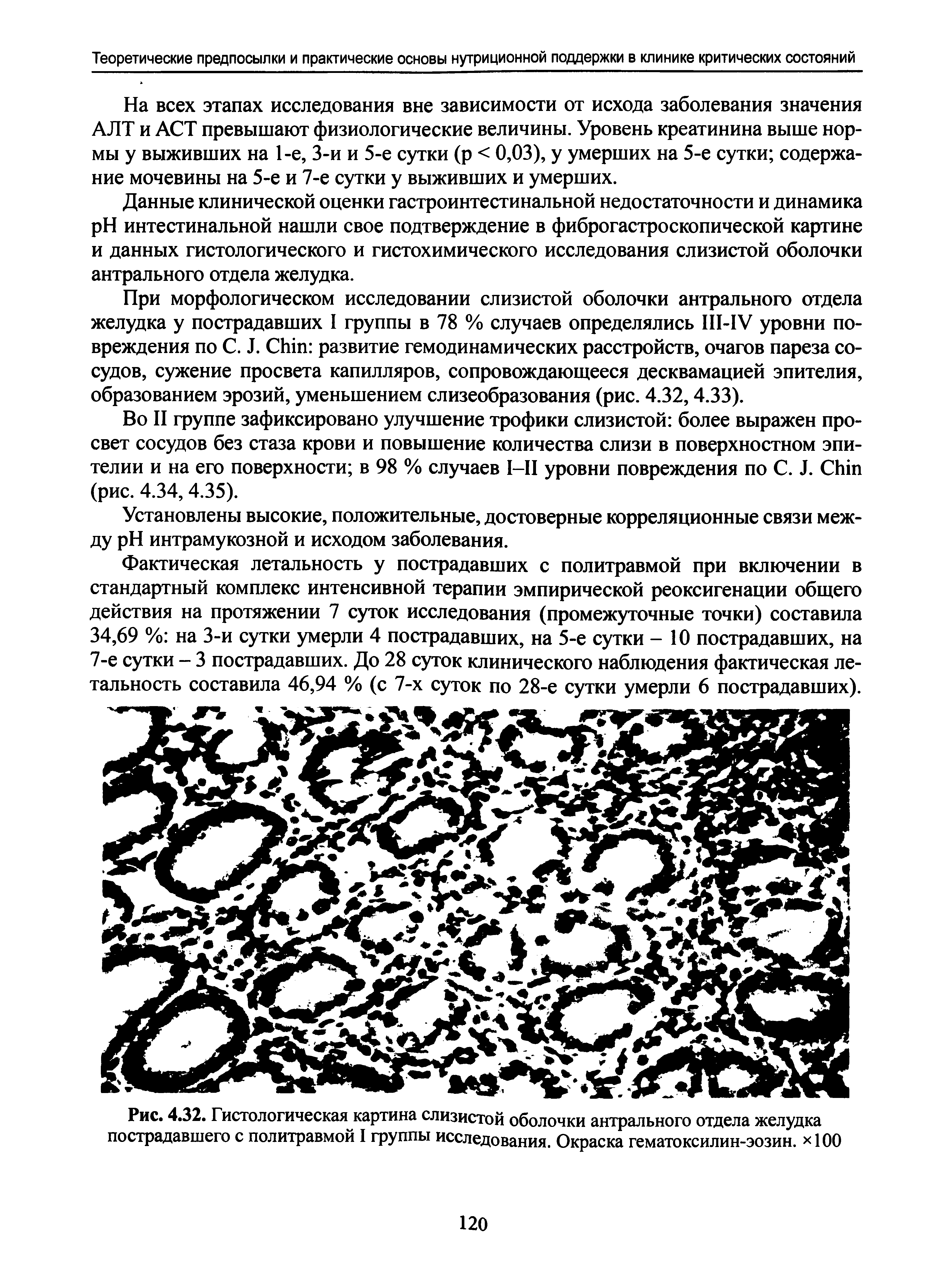 Рис. 4.32. Гистологическая картина слизистой оболочки антрального отдела желудка пострадавшего с политравмой I группы исследования. Окраска гематоксилин-эозин. 100...