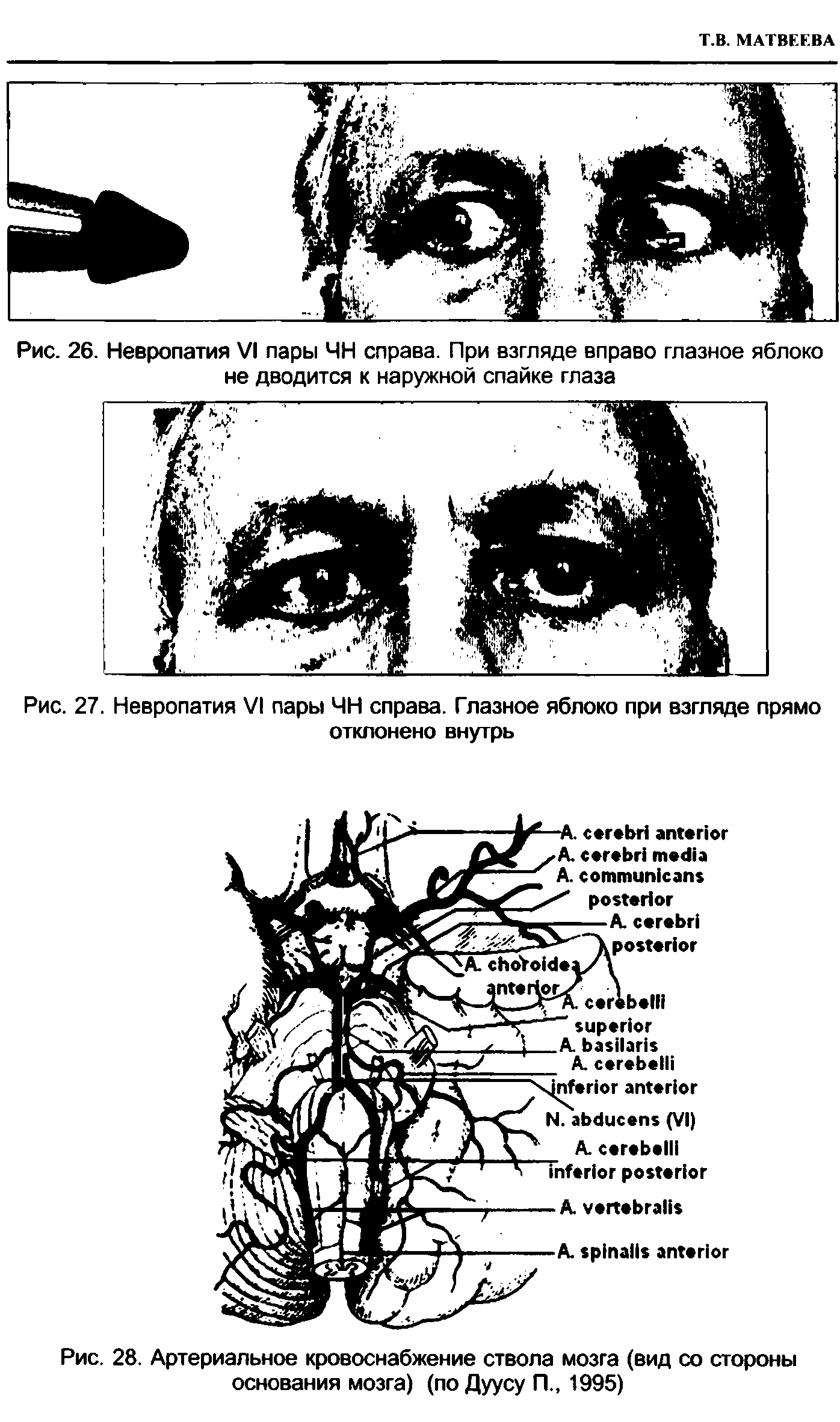 Рис. 28. Артериальное кровоснабжение ствола мозга (вид со стороны основания мозга) (по Дуусу П., 1995)...