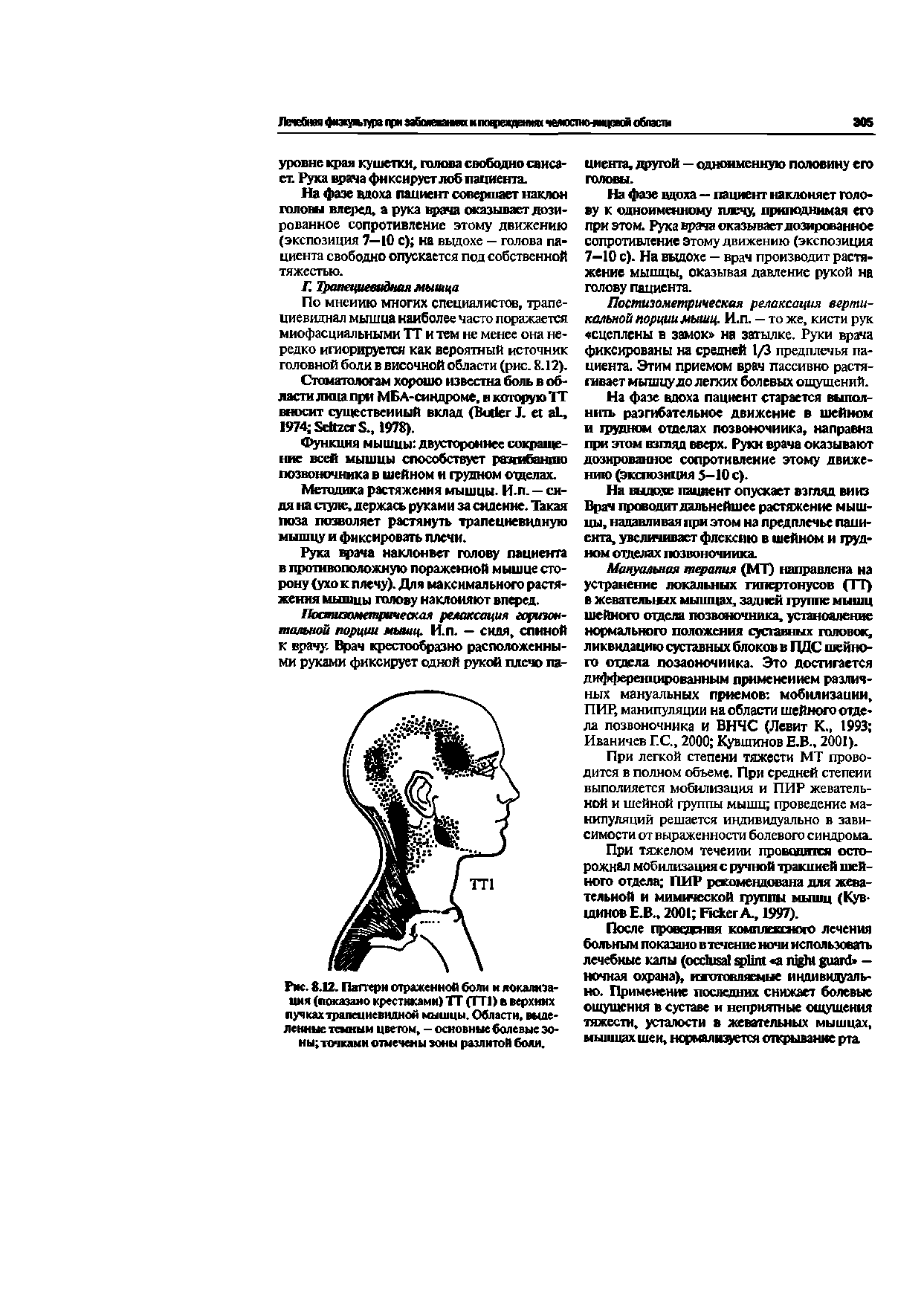 Рис. 8.12. Паттерн отраженной боли и локализация (показано крестнкамн)ТТ (ТТ1)вверхинх пучках трапециевидной мышцы. Области, выделенные темным цветом, - основные болевые эоны точками отмечены зоны разлитой боли.