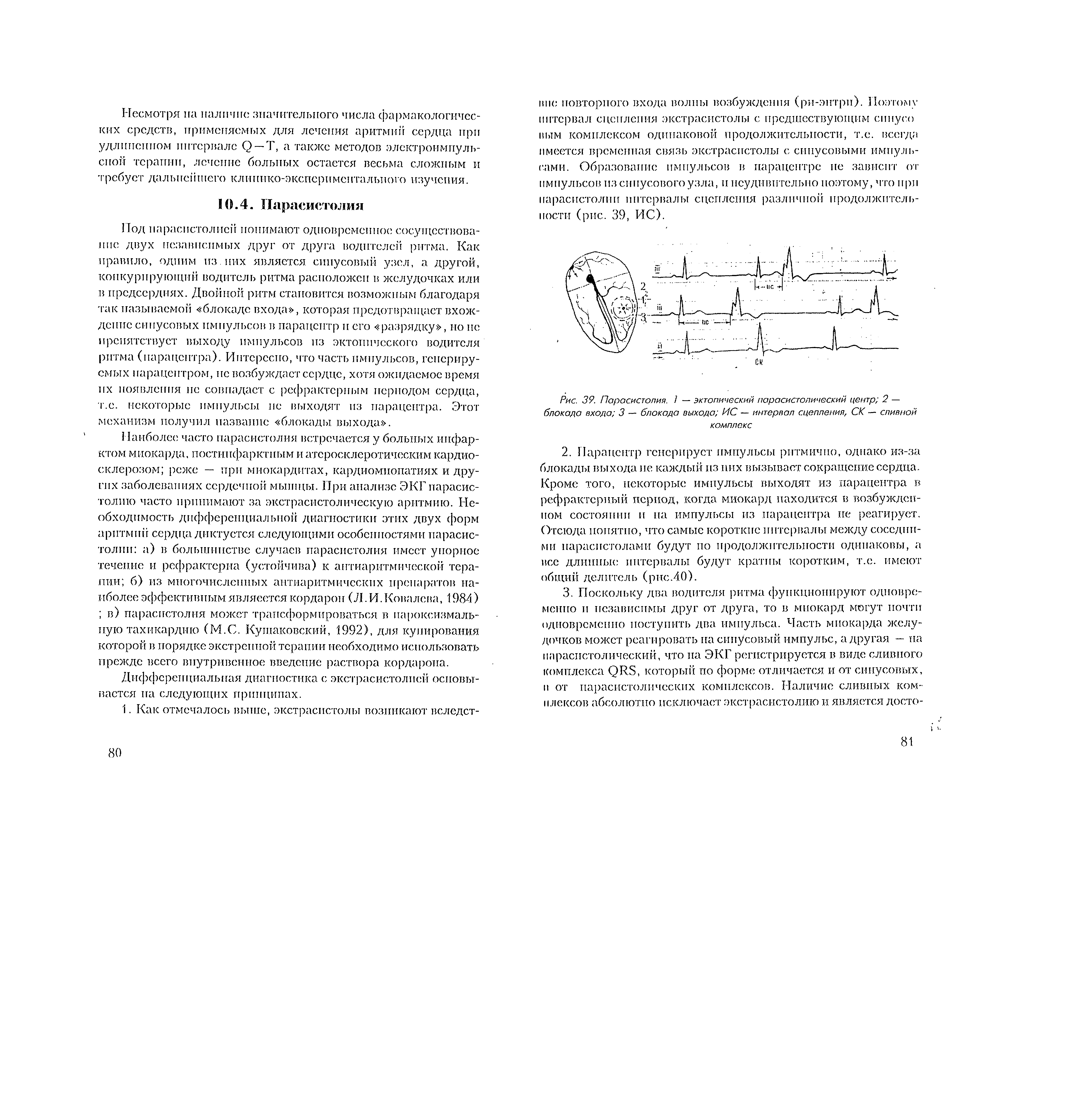 Рис. 39. Парасистолия. 1 — эктопический парасистолический центр 2 — блокада входа 3 — блокада выхода ИС — интервал сцепления, СК — сливной комплекс...