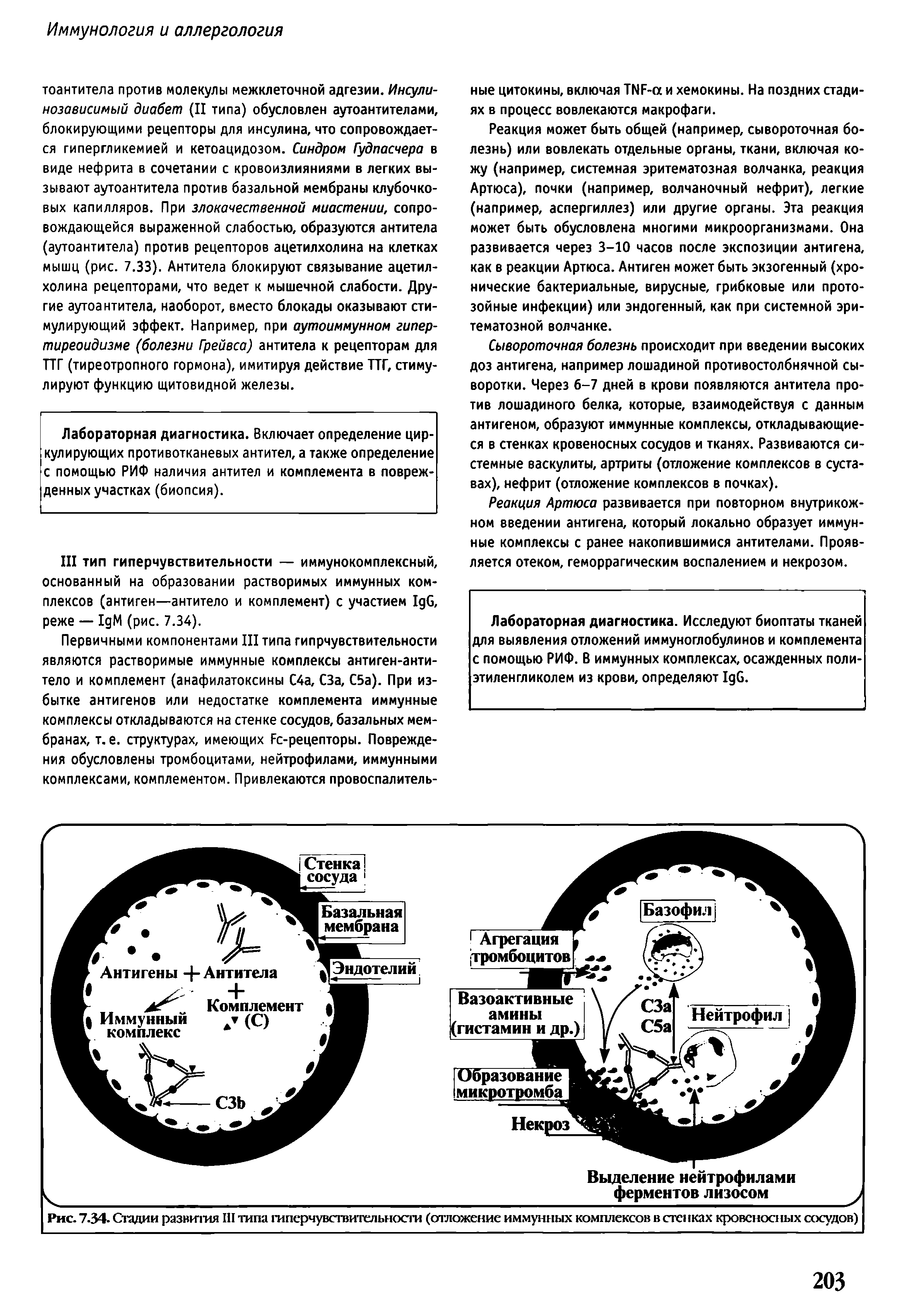 Рис. 7-34- Стадии развития III типа гиперчувствительности (отложение иммунных комплексов в стенках кровеносных сосудов)...