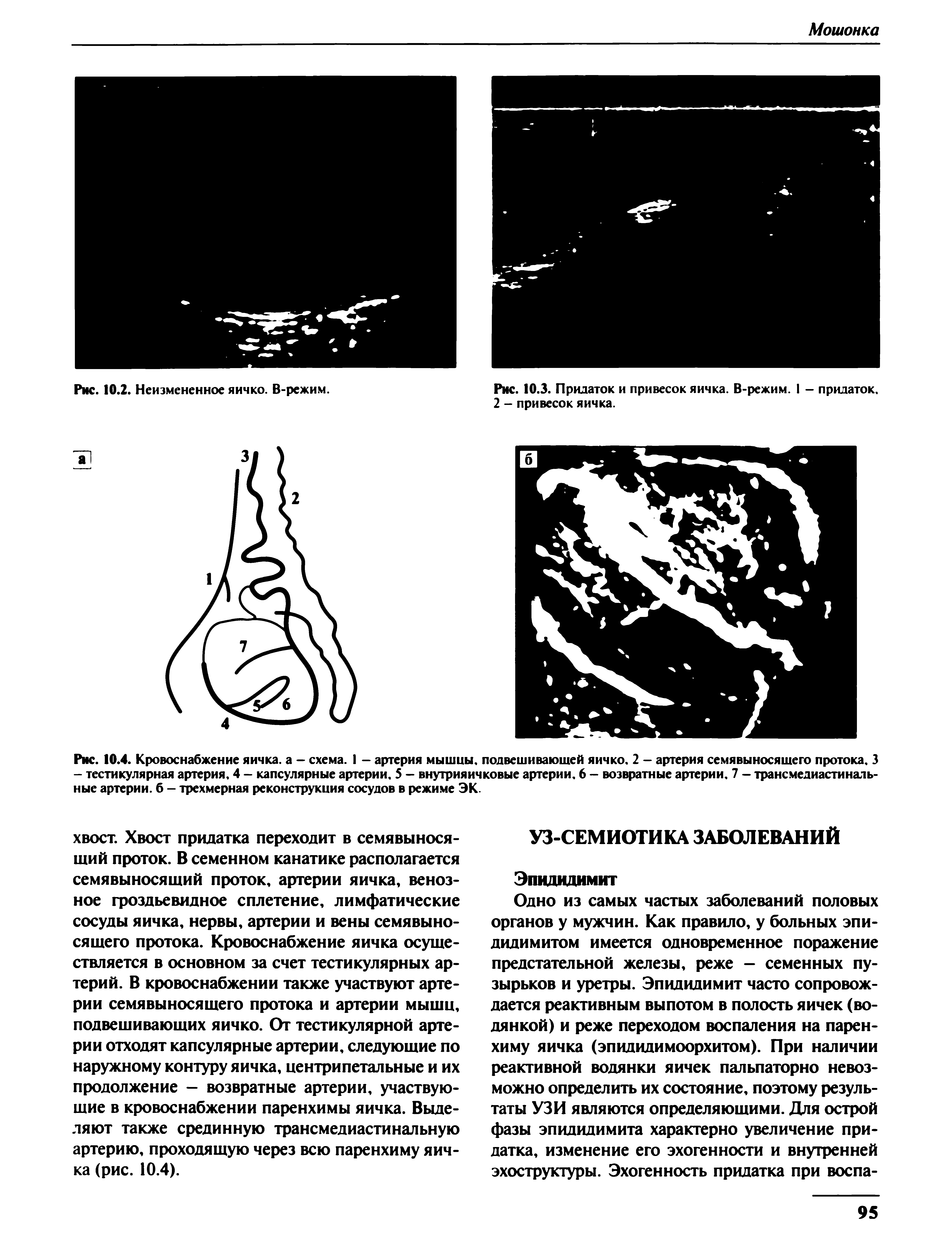 Рис. 10.4. Кровоснабжение яичка, а - схема. 1 - артерия мышцы, подвешивающей яичко. 2 - артерия семявыносящего протока. 3 - тестикулярная артерия, 4 - капсулярные артерии. 5 — внутрияичковые артерии. 6 — возвратные артерии. 7 — трансмедиастинальные артерии, б - трехмерная реконструкция сосудов в режиме ЭК.