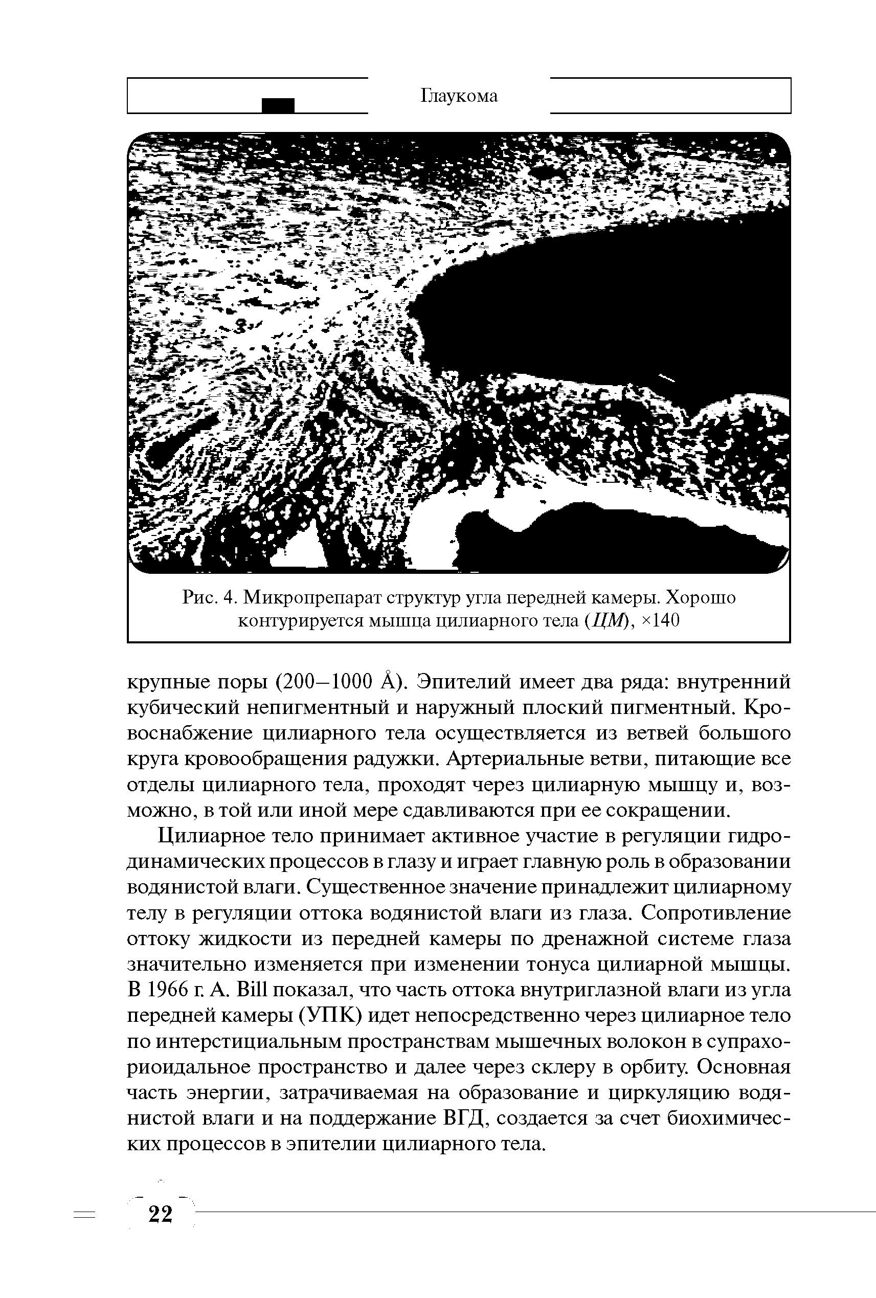 Рис. 4. Микропрепарат структур угла передней камеры. Хорошо контур ируется мышца цилиарного тела (ИМ). 140...