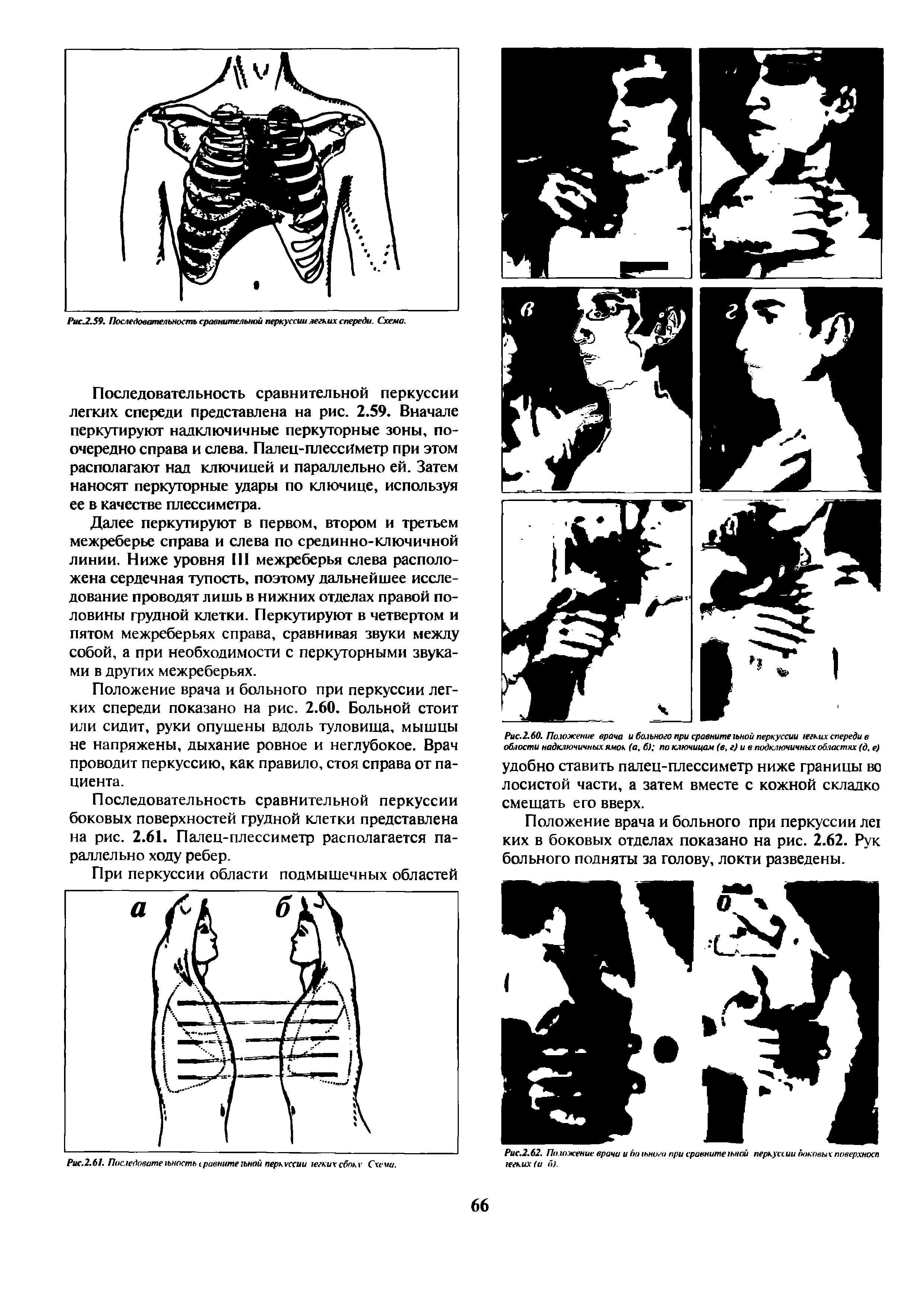 Рис.2.62. Положение врачи и /иньнига при сравнитегьной перкуссии юковых поверхносп гегких (и б).