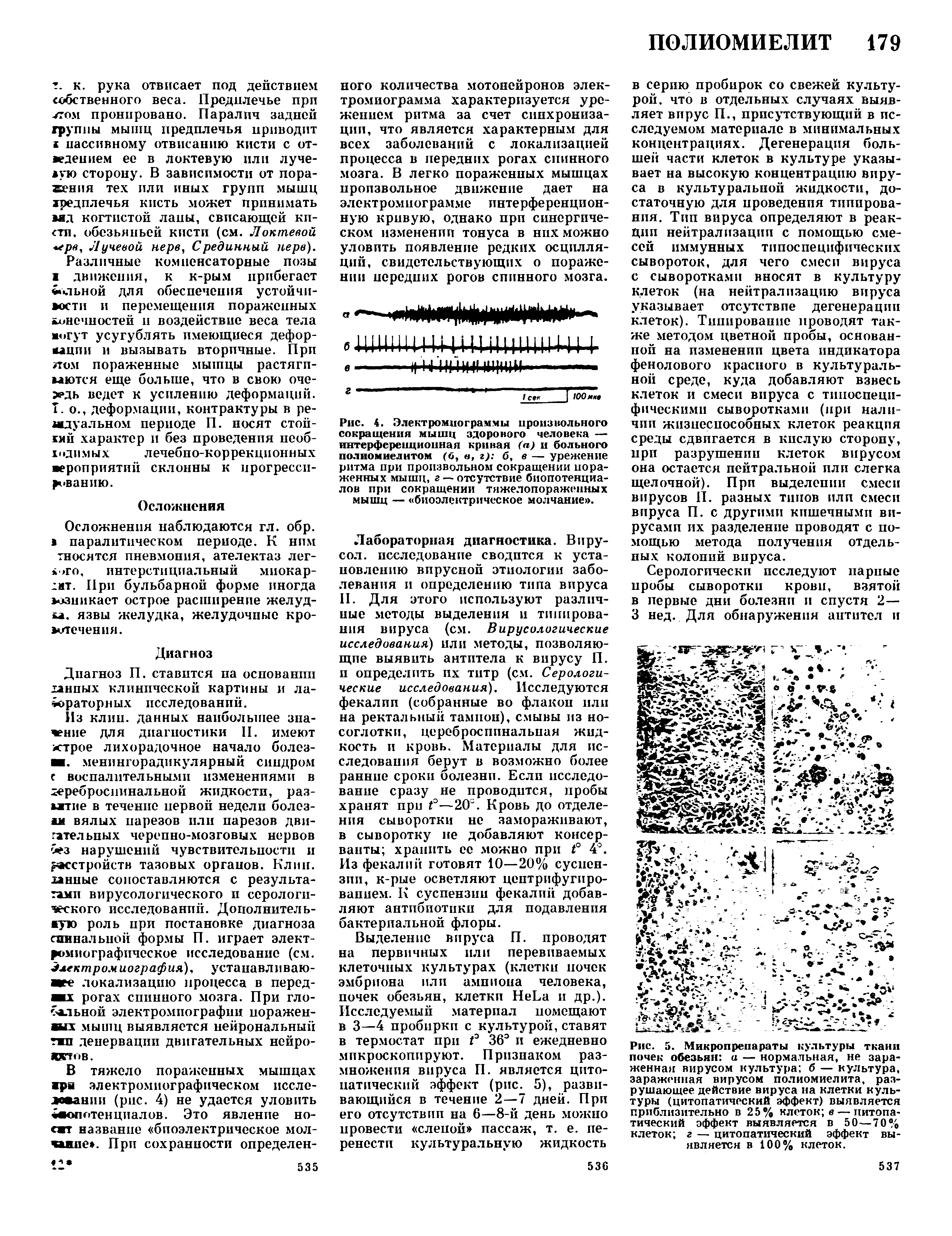 Рис. 5. Микропрепараты культуры ткани почек обезьян а — нормальная, не зараженная вирусом культура б — культура, зараженная вирусом полиомиелита, разрушающее действие вируса на клетки культуры (цитопатический эффект) выявляется приблизительно в 25% клеток в — питопа-тический эффект выявляется в 50—70% клеток г — цитопатический эффект выявляется в 100% клеток.