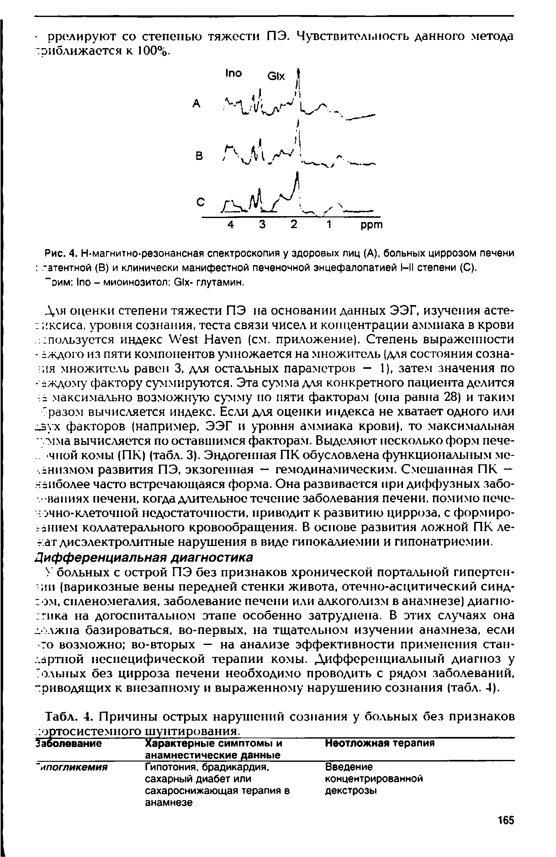 Рис. 4. Н-магнитно-резонансная спектроскопия у здоровых лиц (А), больных циррозом печени -атентной (В) и клинически манифестной печеночной энцефалопатией 1-11 степени (С).