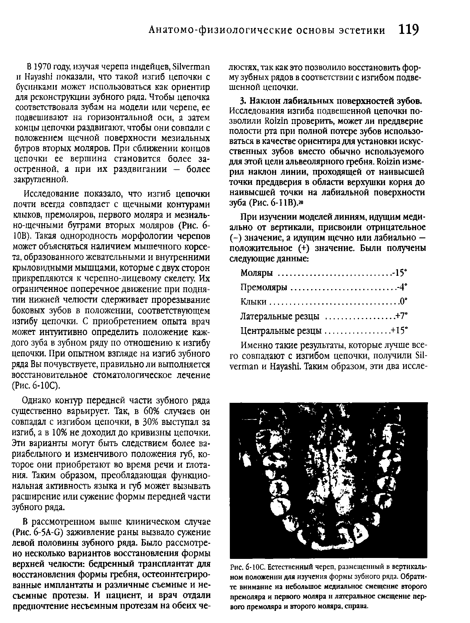 Рис. 6-ЮС. Естественный череп, размещенный в вертикальном положении для изучения формы зубного ряда. Обратите внимание на небольшое медиальное смещение второго премоляра и первого маляра и латеральное смещение первого премоляра и второго моляра, справа.