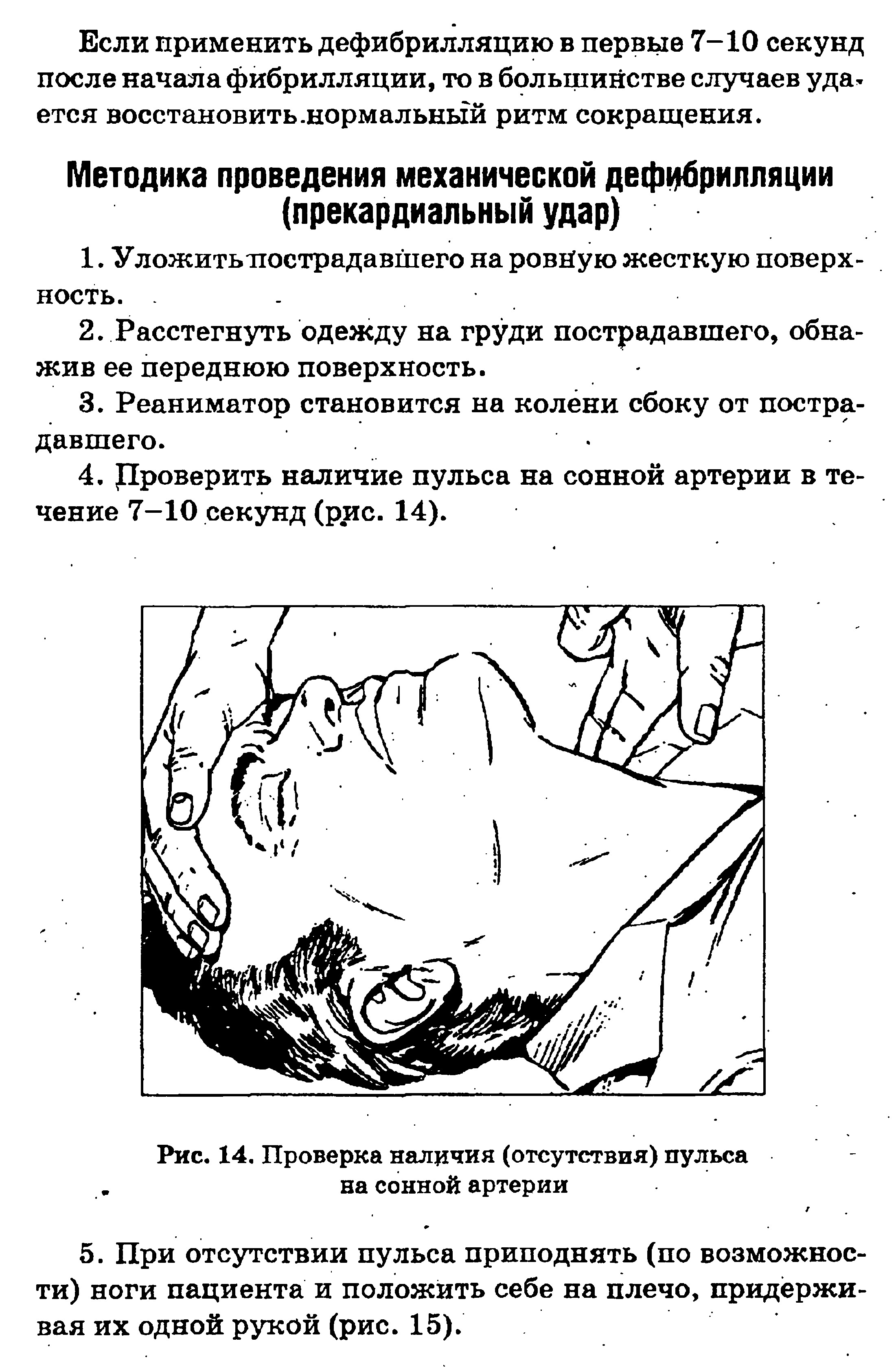 Рис. 14. Проверка наличия (отсутствия) пульса на сонной артерии...