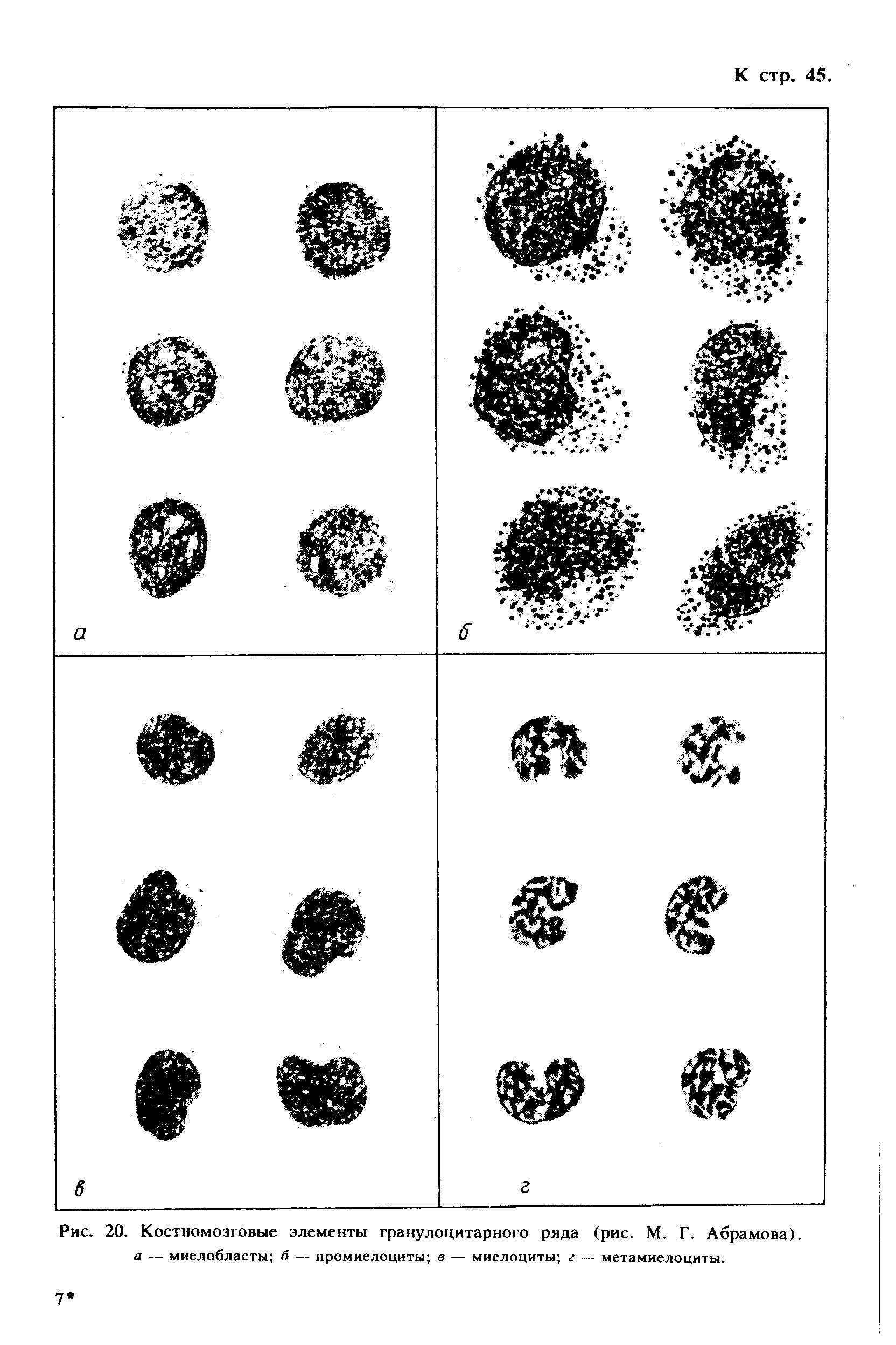 Рис. 20. Костномозговые элементы гранулоцитарного ряда (рис. М. Г. Абрамова). а — миелобласты б — промиелоциты в — миелоциты г — метамиелоциты.