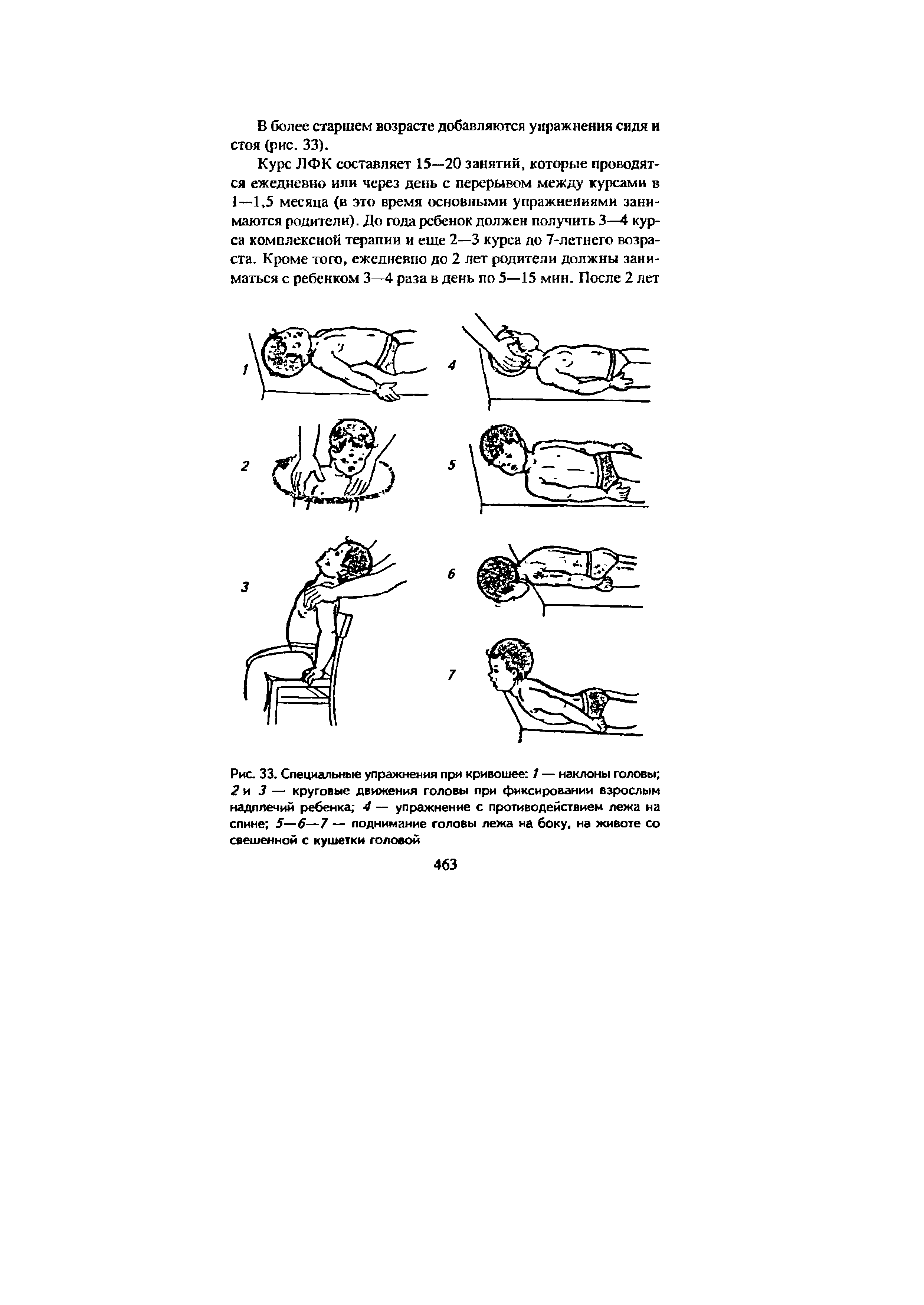 Рис. 33. Специальные упражнения при кривошее 1 — наклоны головы 2 и 3 — круговые движения головы при фиксировании взрослым надллечий ребенка 4 — упражнение с противодействием лежа на спине 5—6—7 — поднимание головы лежа на боку, на животе со свешенной с кушетки головой...