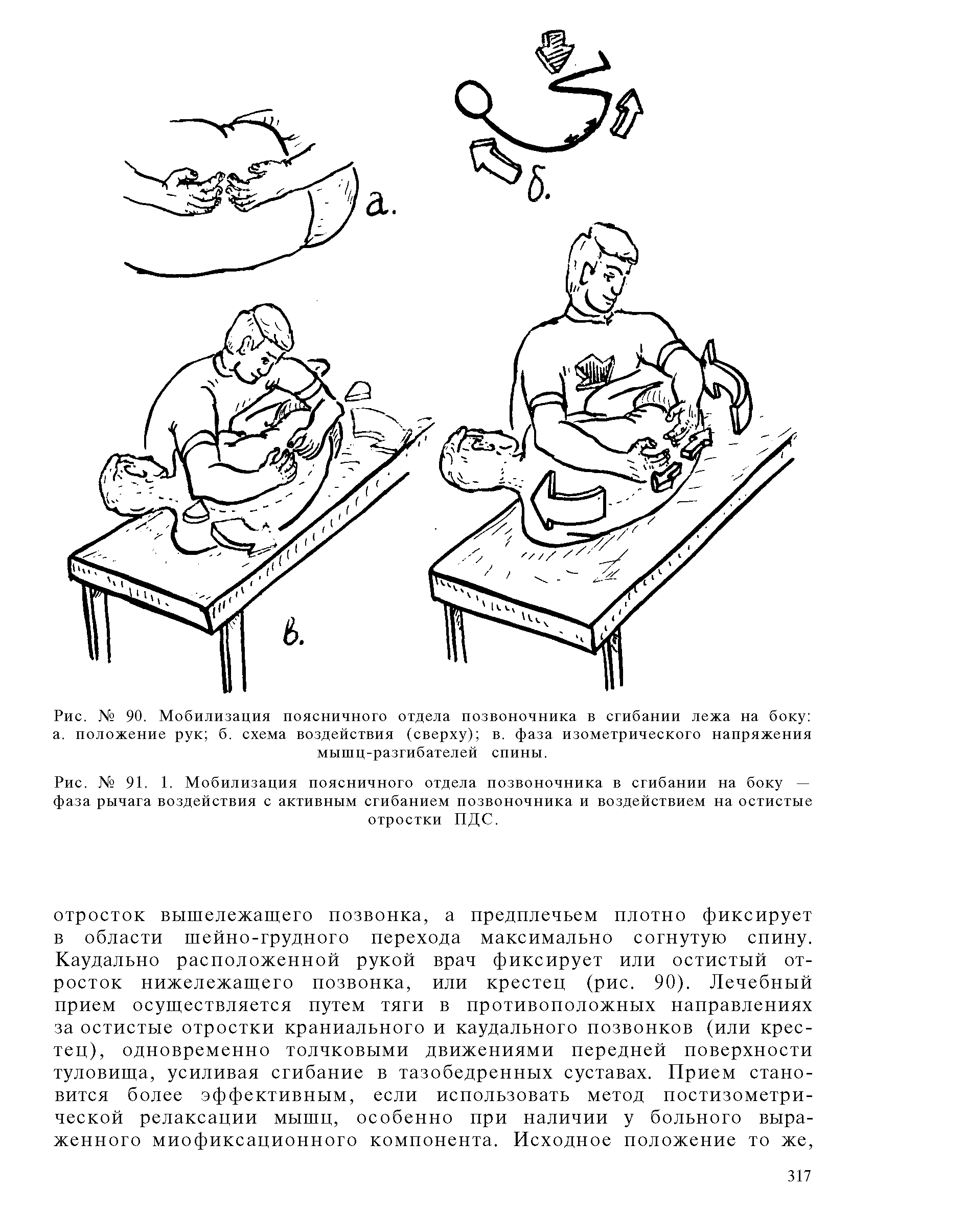 Рис. № 91. 1. Мобилизация поясничного отдела позвоночника в сгибании на боку — фаза рычага воздействия с активным сгибанием позвоночника и воздействием на остистые отростки ПДС.