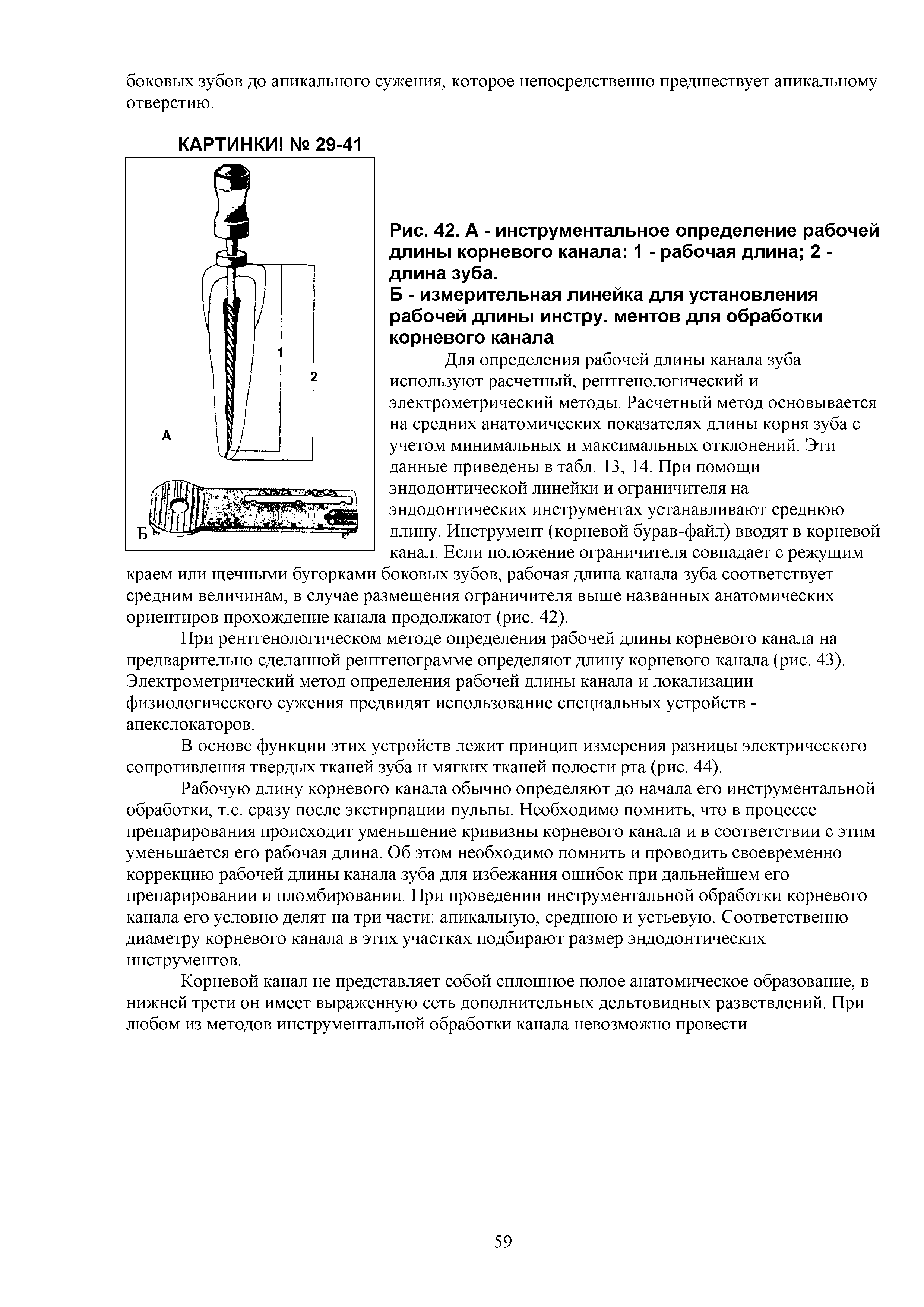 Рис. 42. А - инструментальное определение рабочей длины корневого канала 1 - рабочая длина 2 -длина зуба.