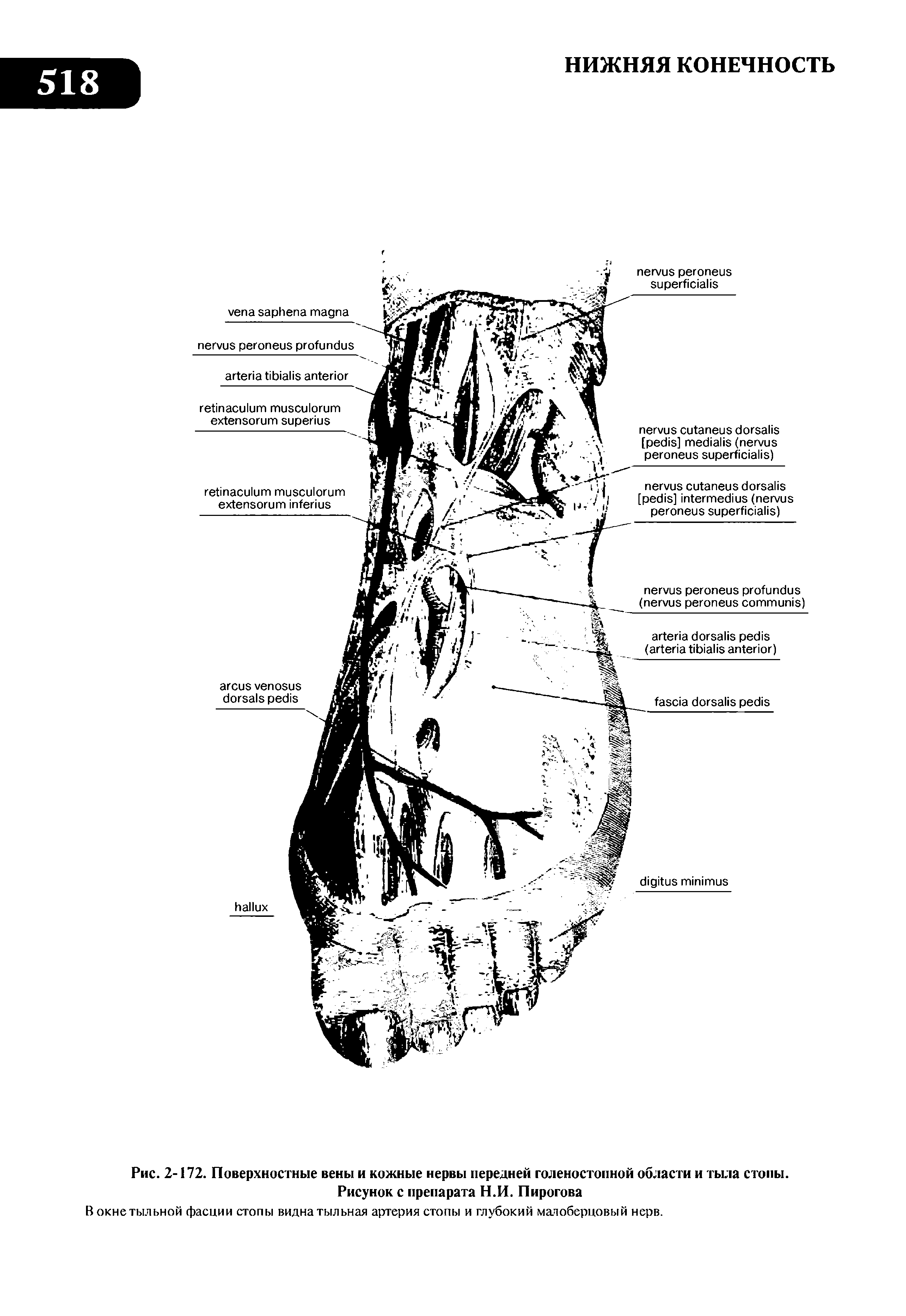 Рис. 2-172. Поверхностные вены и кожные нервы передней голеностопной области и тыла стопы. Рисунок с препарата Н.П. Пирогова...