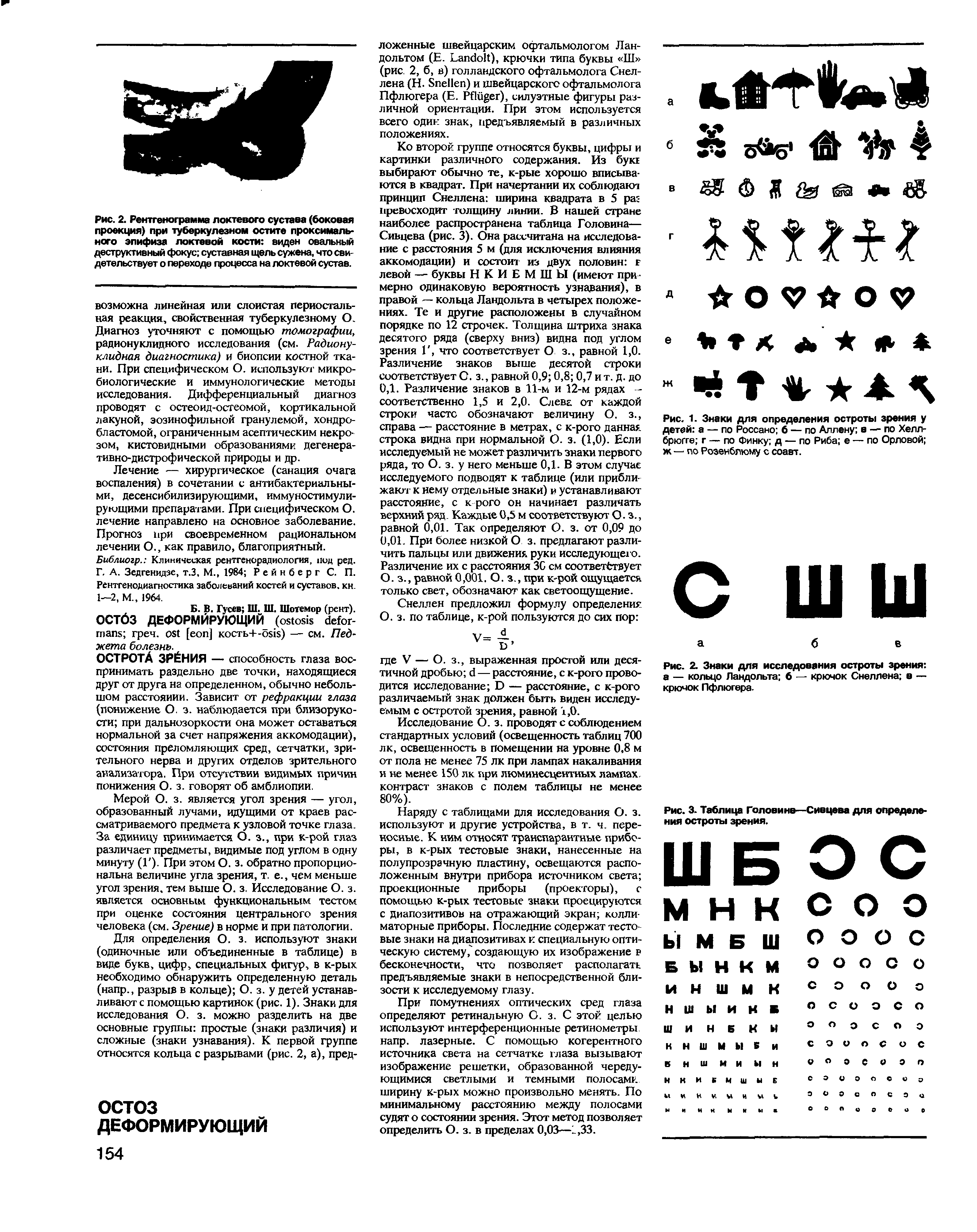 Рис. 1. Знаки для определения остроты зрения у детей а — по Россано б — по Аллену а — по Хелл-брюгге г — по Финку д — по Риба е — по Орловой ж — по Розенблюму с соавт.