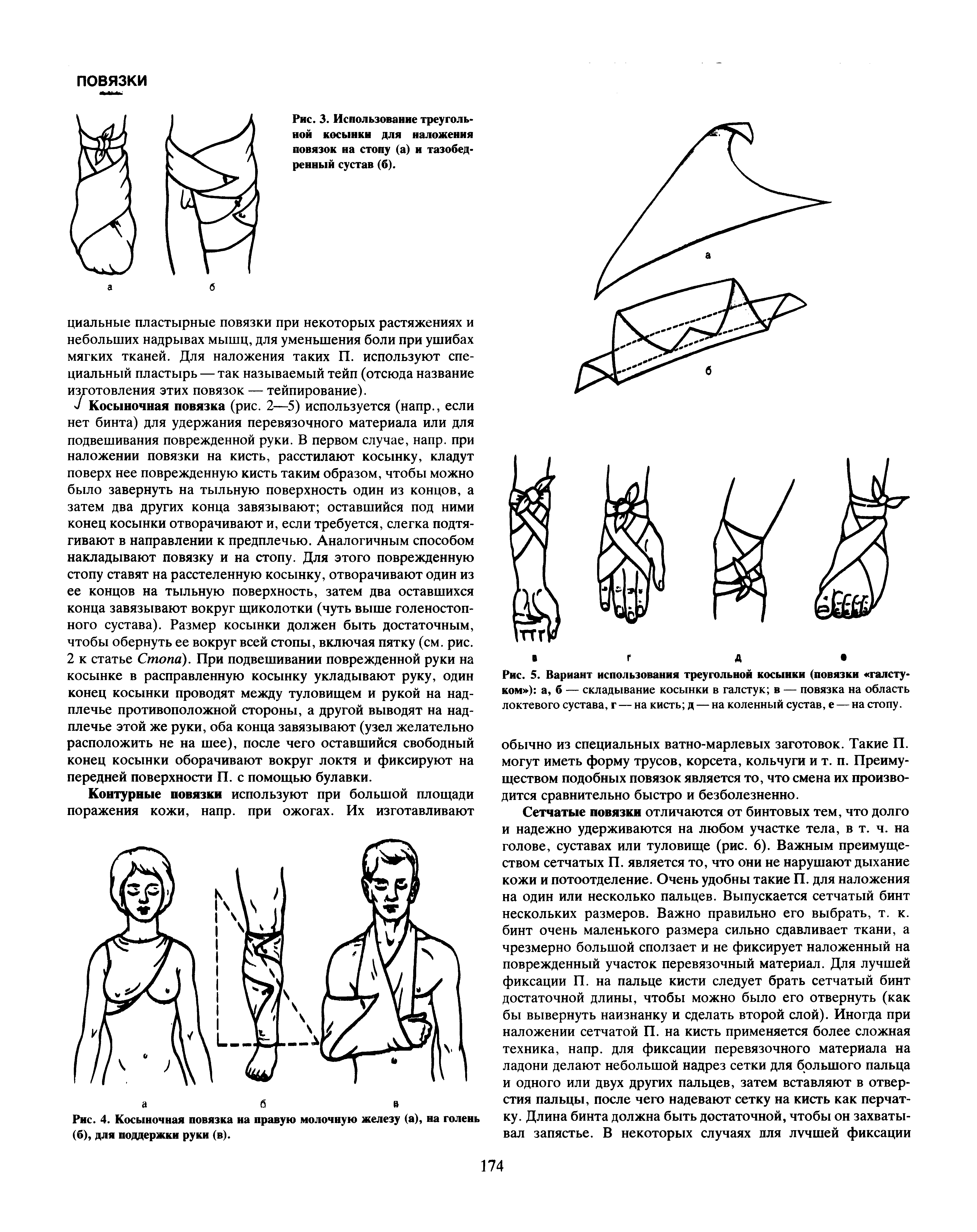 Рис. 5. Вариант использования треугольной косынки (повязки галстуком ) а, б — складывание косынки в галстук в — повязка на область локтевого сустава, г — на кисть д — на коленный сустав, е — на стопу.