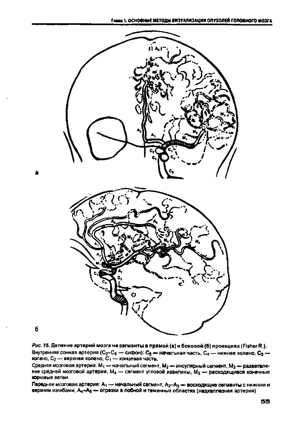 Рис. 15. Деление артерий мозга на сегменты а прямой (а) и боковой (б) проекциях (F R,), Внутренняя сонная артерия (C -C — сифон) C — начальная часть, С4 — нижнее колено, C — колено, С — верхнее колено, C — концевая часть.