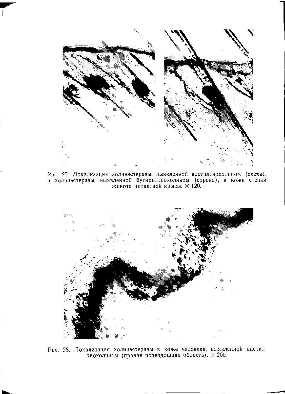 Рис. 28. Локализация холинэстеразы в коже человека, выявленной ацетил-тиохолином (правая подвздошная область). X 200.