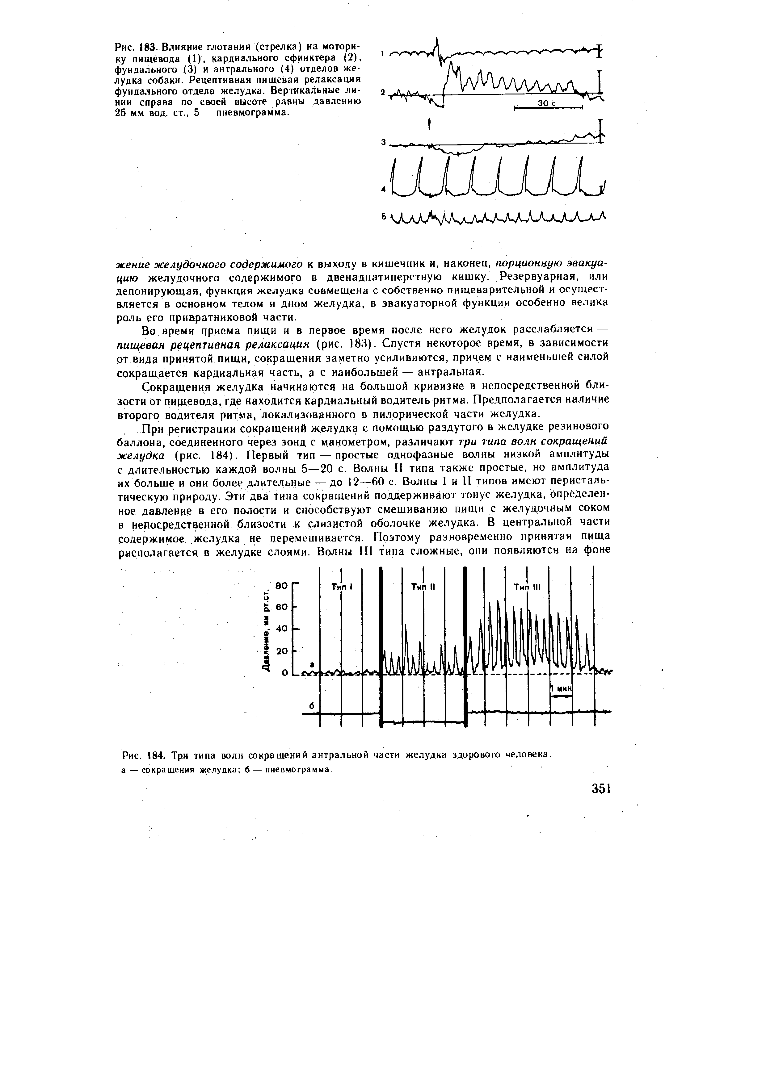 Рис. 184. Три типа волн сокращений антральной части желудка здорового человека, а— сокращения желудка б — пневмограмма.
