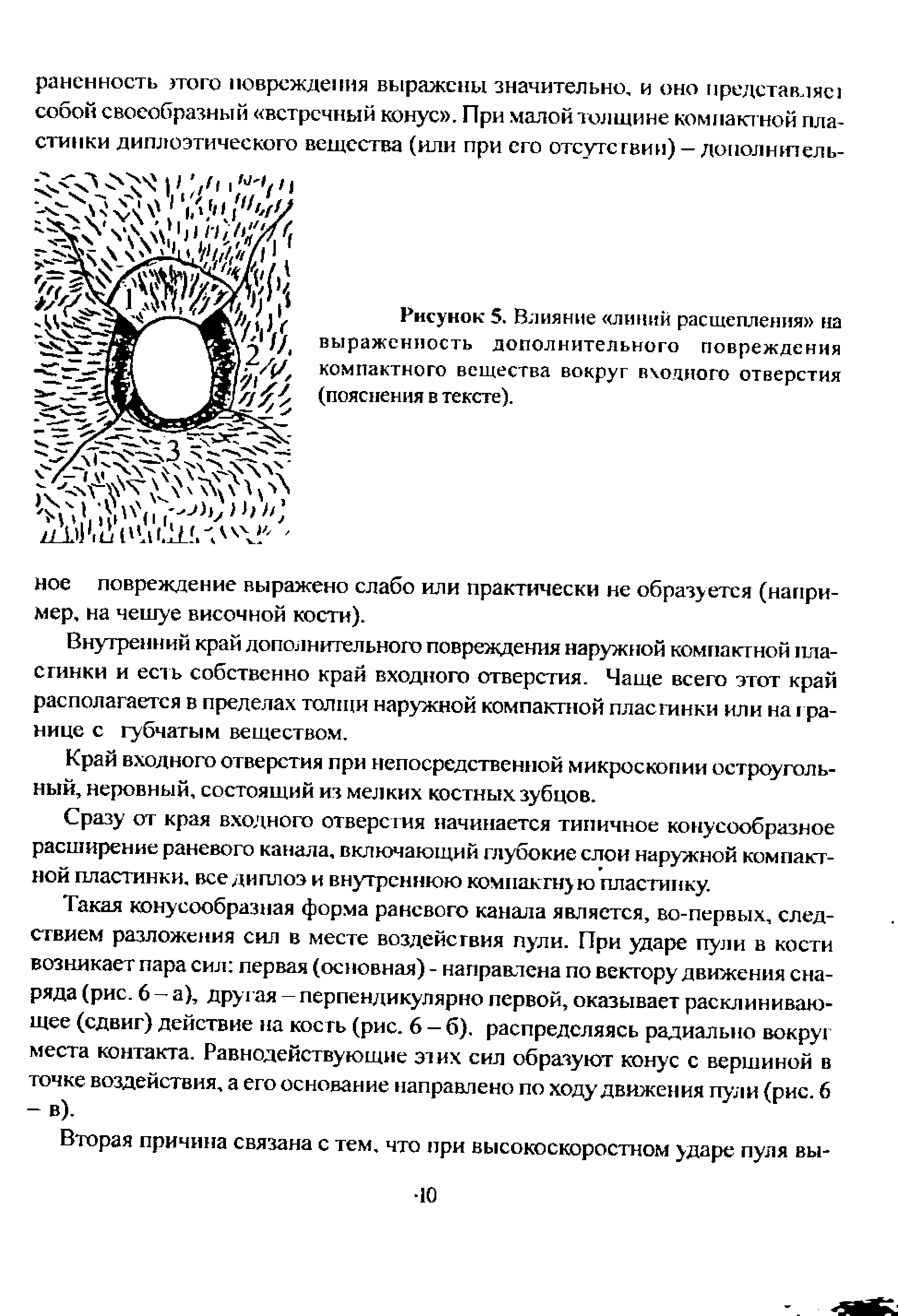 Рисунок5. Влияние линий расщепления на выраженность дополнительного повреждения компактного вещества вокруг входного отверстия (пояснения в тексте).