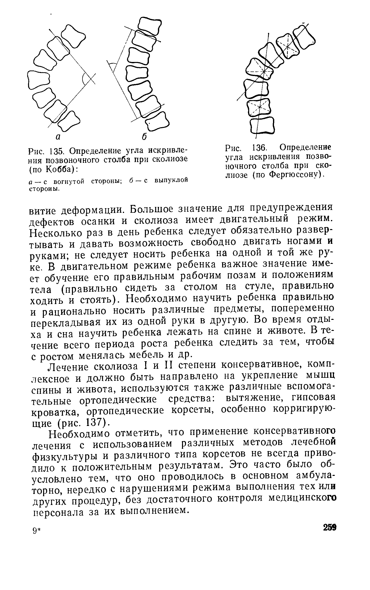 Рис. 135. Определение угла искривления позвоночного столба при сколиозе (по Кобба) ...