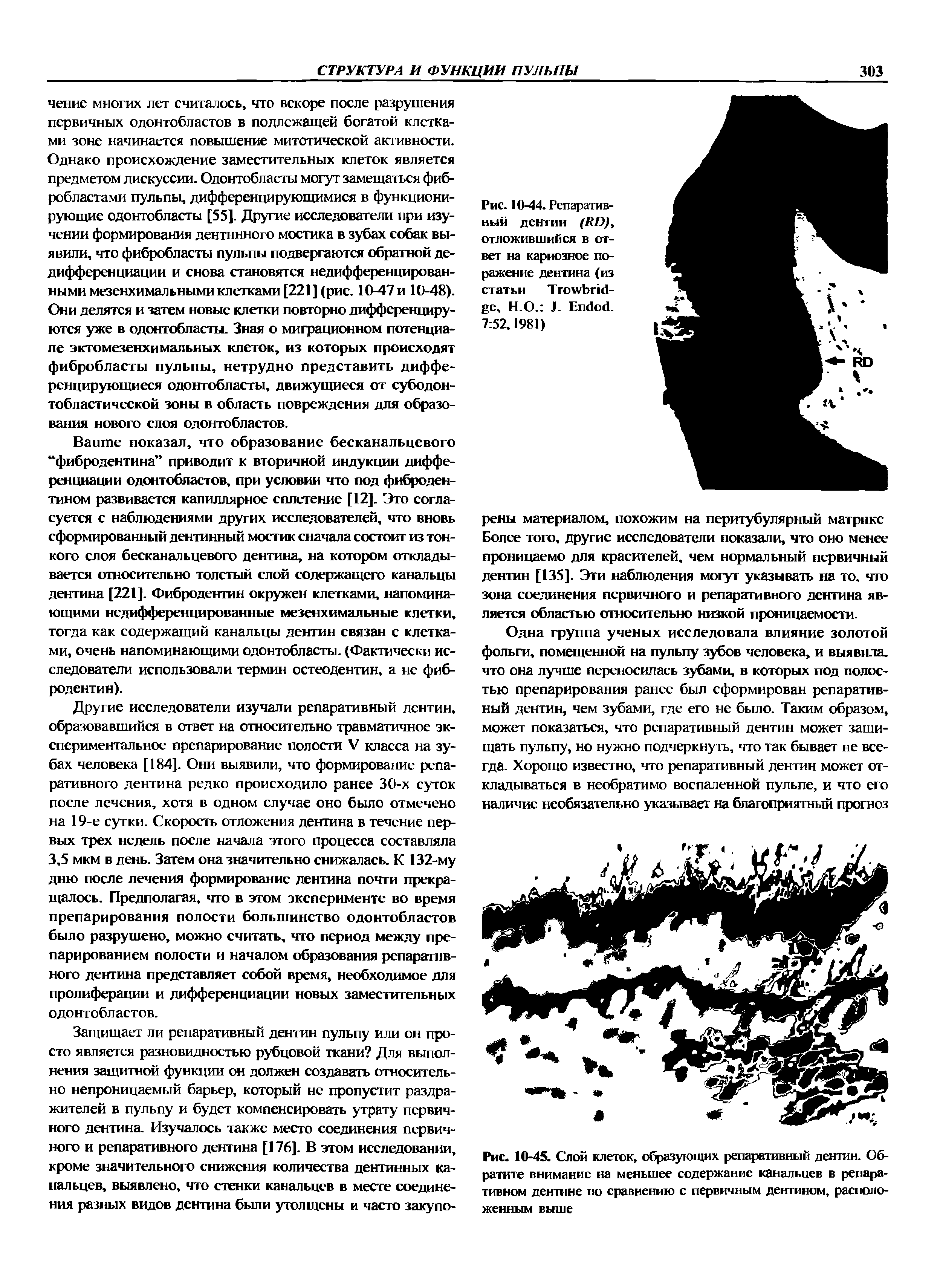 Рис. 10-45. Слой клеток, образующих репаративный дентин. Обратите внимание на меньшее содержание канальцев в репаративном дентине по сравнению с первичным дентином, расположенным выше...