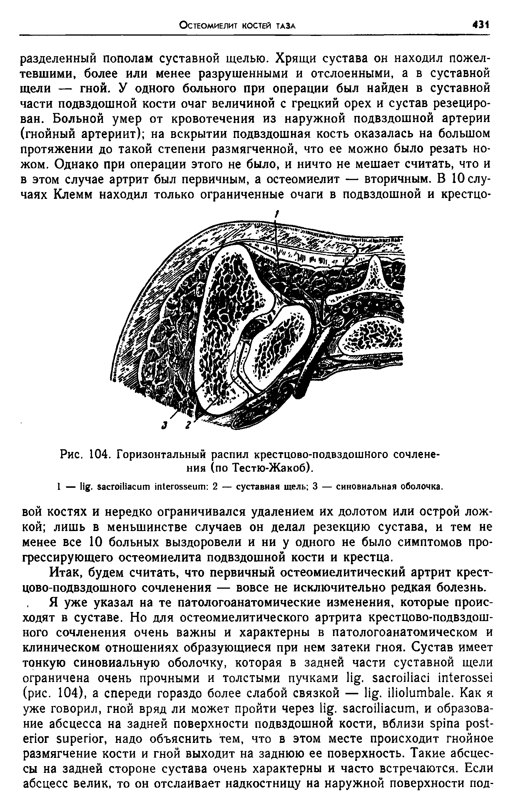 Рис. 104. Горизонтальный распил крестцово-подвздошного сочленения (по Тестю-Жакоб).