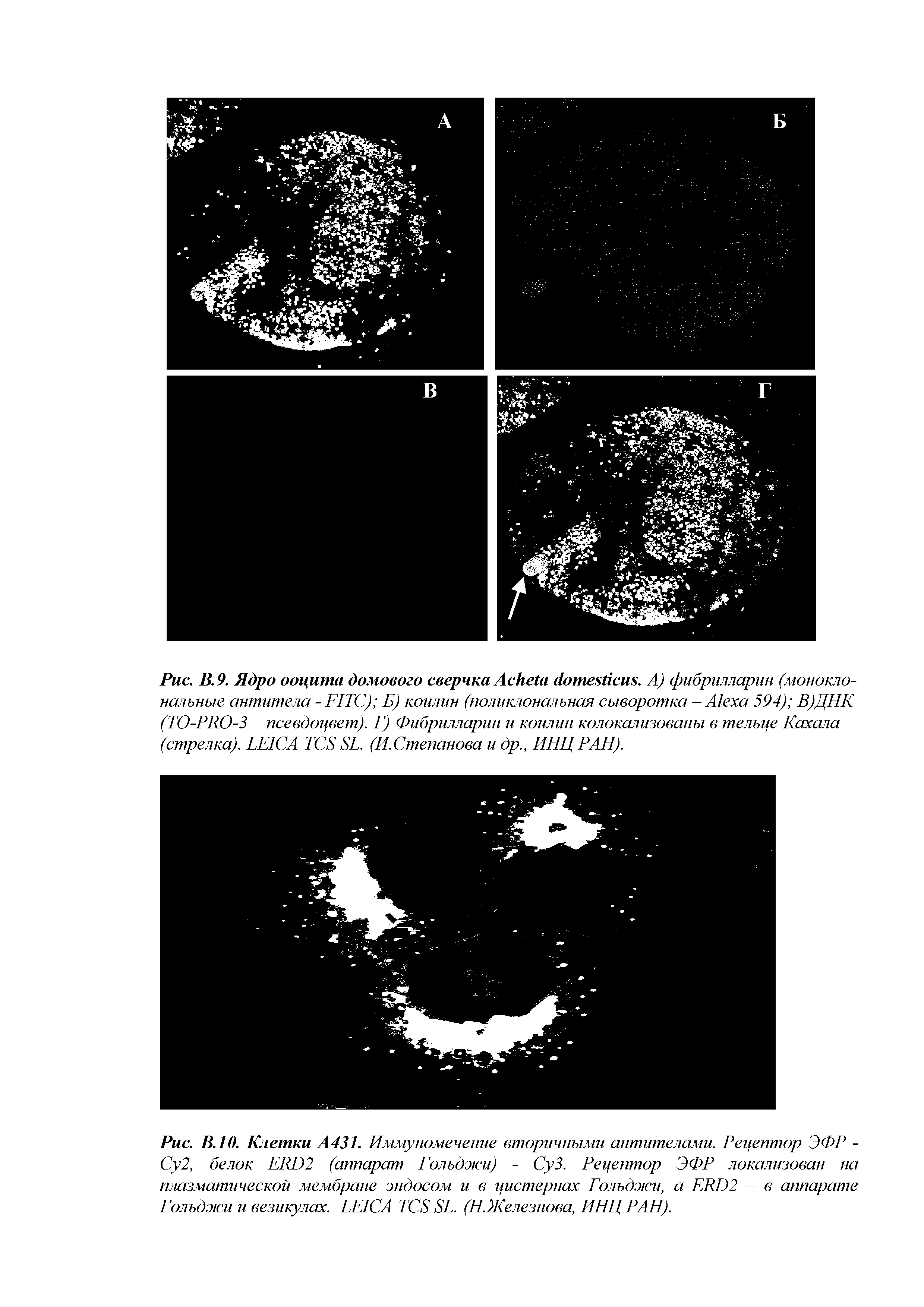 Рис. В. 10. Клетки А431. Иммуномечение вторичными антителами. Рецептор ЭФР -Су2, белок ERD2 (аппарат Гольджи) - СуЗ. Рецептор ЭФР локализован на плазматической мембране эндосом и в цистернах Гольджи, а ERD2 - в аппарате Гольджи и везикулах. LEICA TCS SL. (НЖелезнова, ИНЦ РАН).