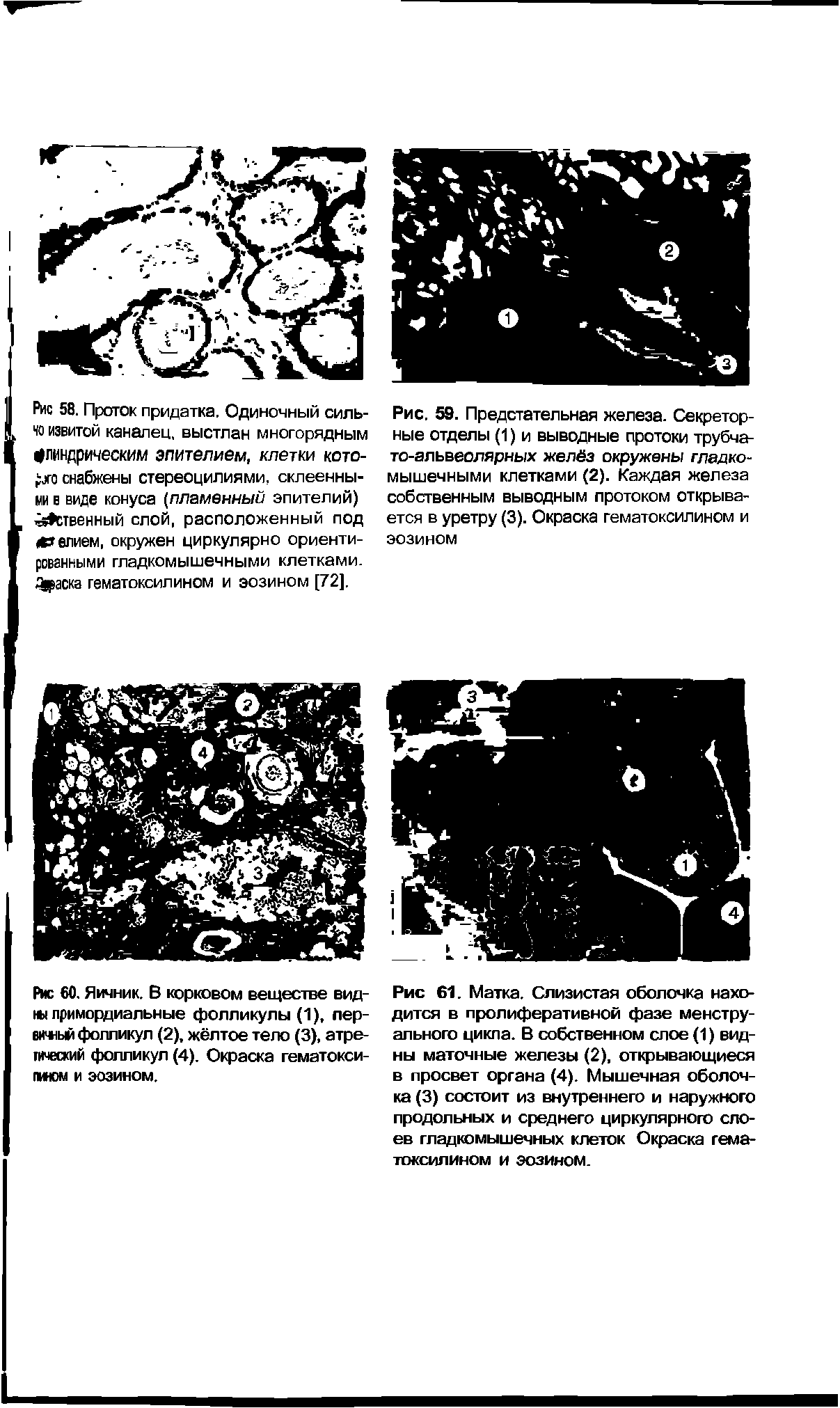 Рис. 59. Предстательная железа. Секреторные отделы (1) и выводные протоки трубчато-альвеолярных желёз окружены гладкомышечными клетками (2). Каждая железа собственным выводным протоком открывается в уретру (3). Окраска гематоксилином и эозином...