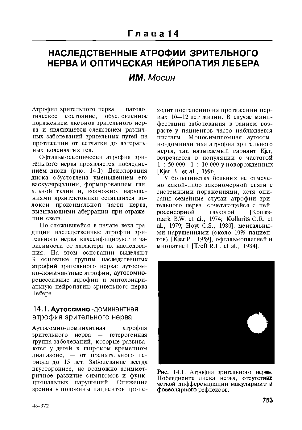 Рис. 14.1. Атрофия зрительного нерва, Побледнение диска нерва, отсутстяне четкой дифференциации макулярного И фовеолярного рефлексов.