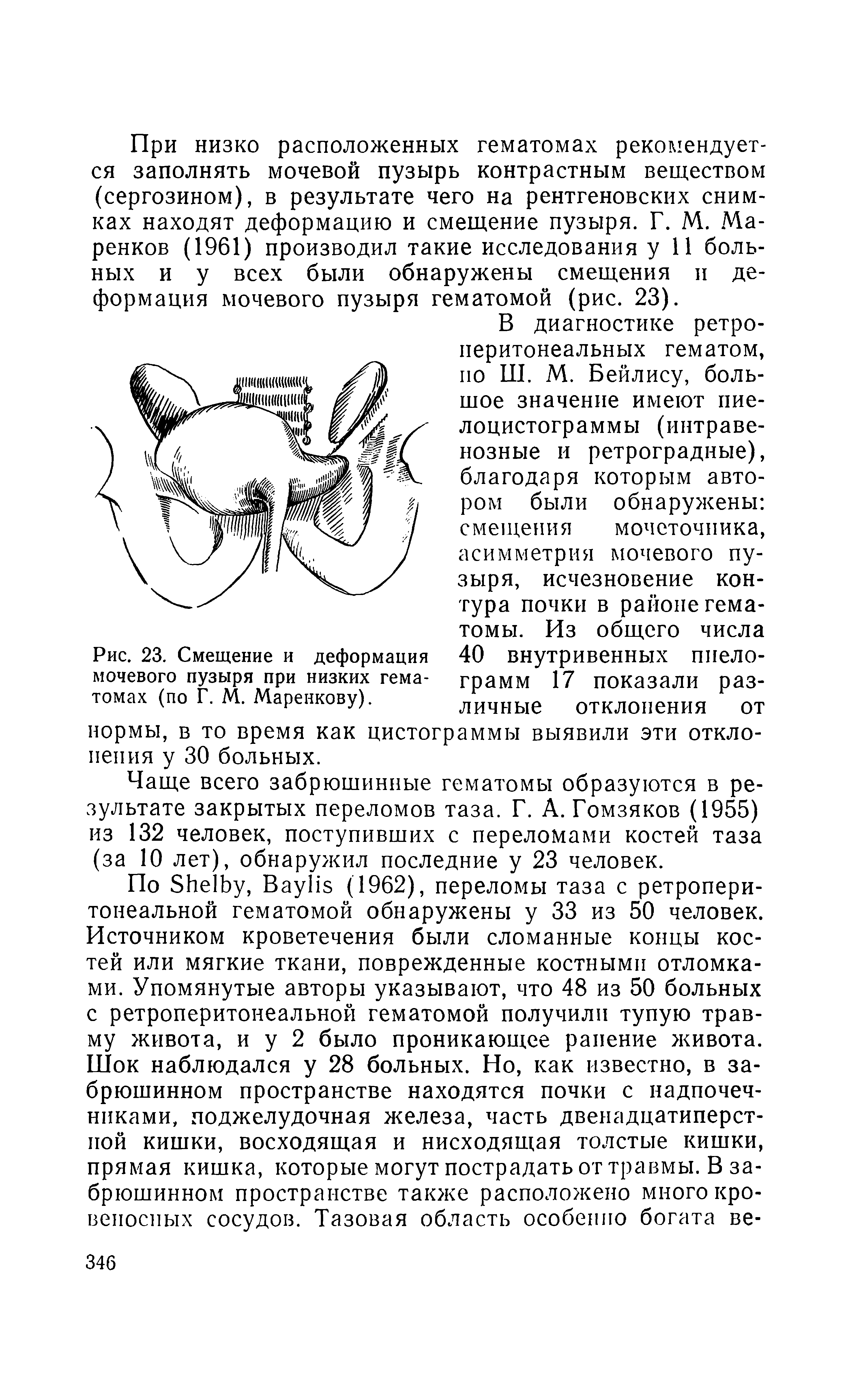 Рис. 23. Смещение и деформация мочевого пузыря при низких гематомах (по Г. М. Маренкову).