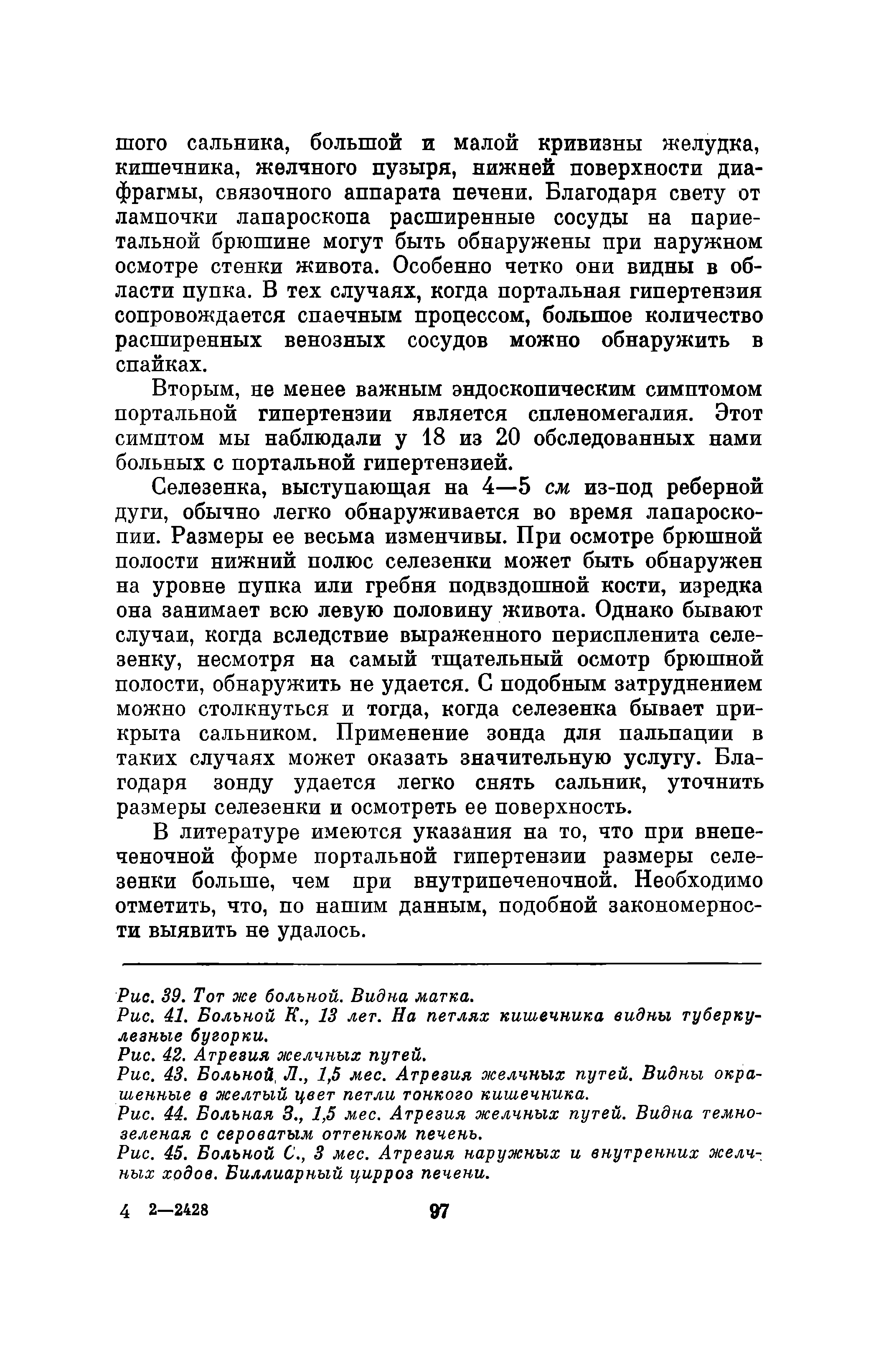 Рис. 43. Больной, Л., 1,5 мес. Атрезия желчных путей. Видны окрашенные в желтый цвет петли тонкого кишечника.